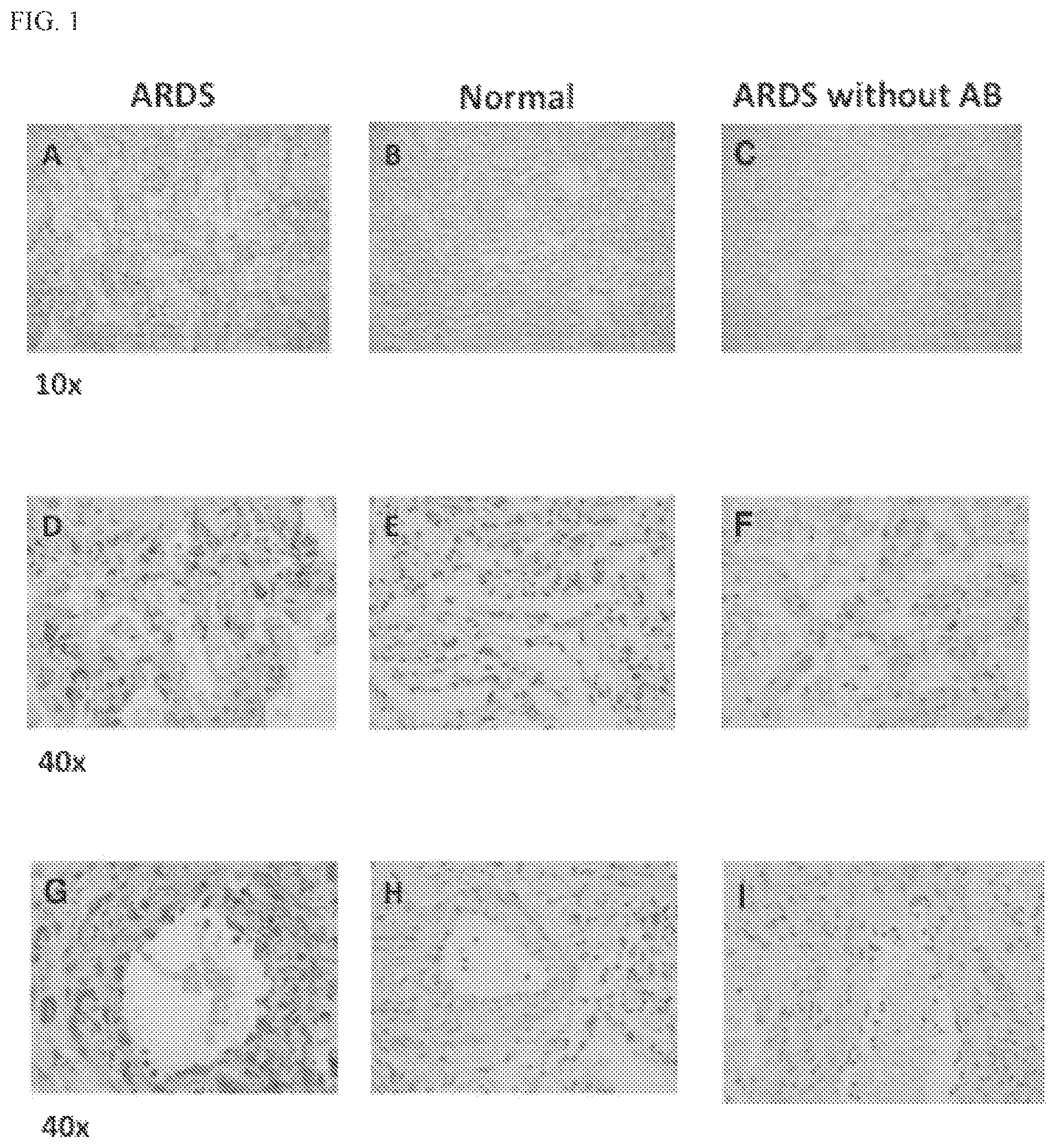 Patent US12569459 — Compositions and methods for treating pulmonary edema or lung inflammation — Figure 1