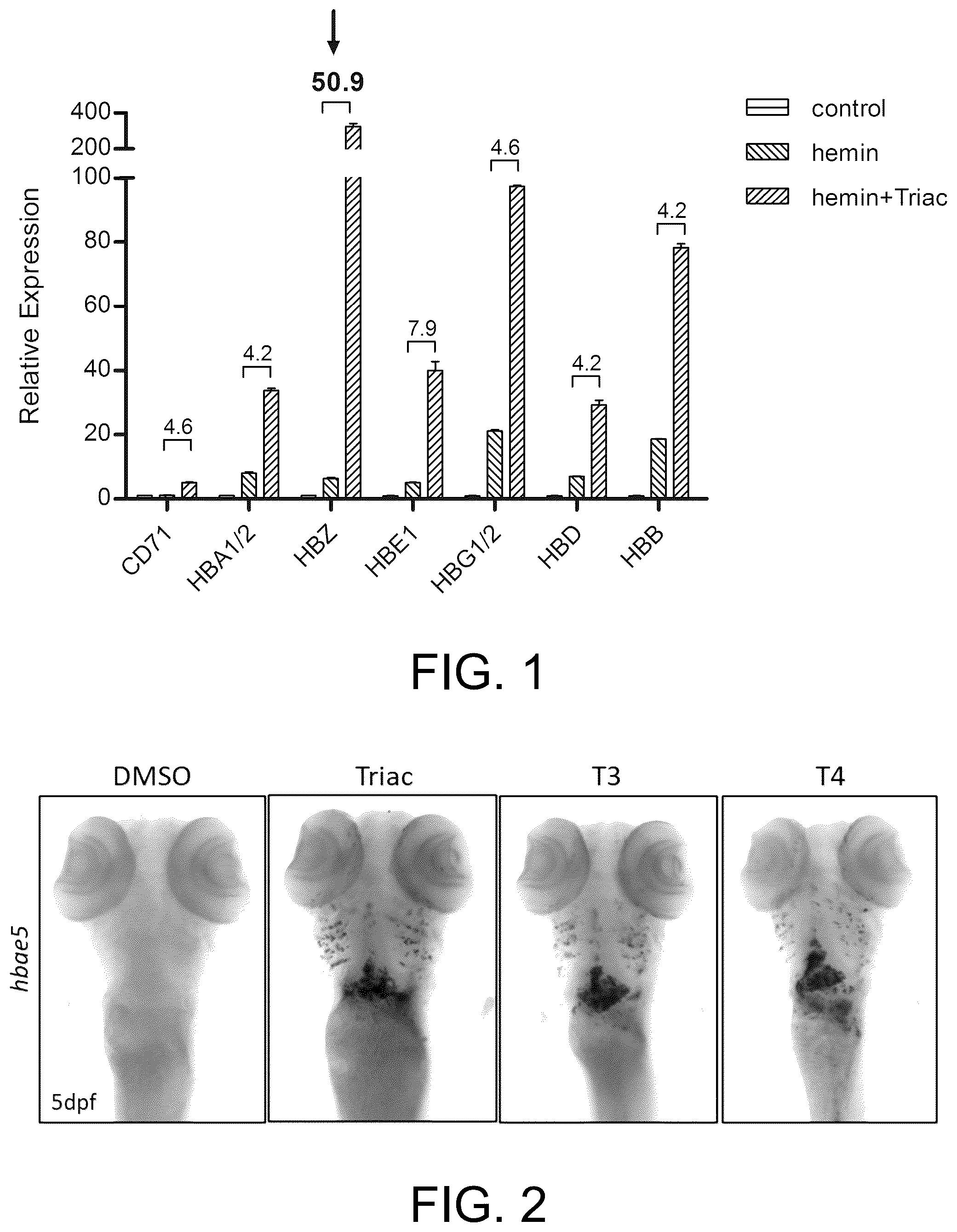 Patent US12569460 — Application of thyroid hormones and thyroid hormone analogues to preparation of drugs for treating sickle-cell disease — Figure 1