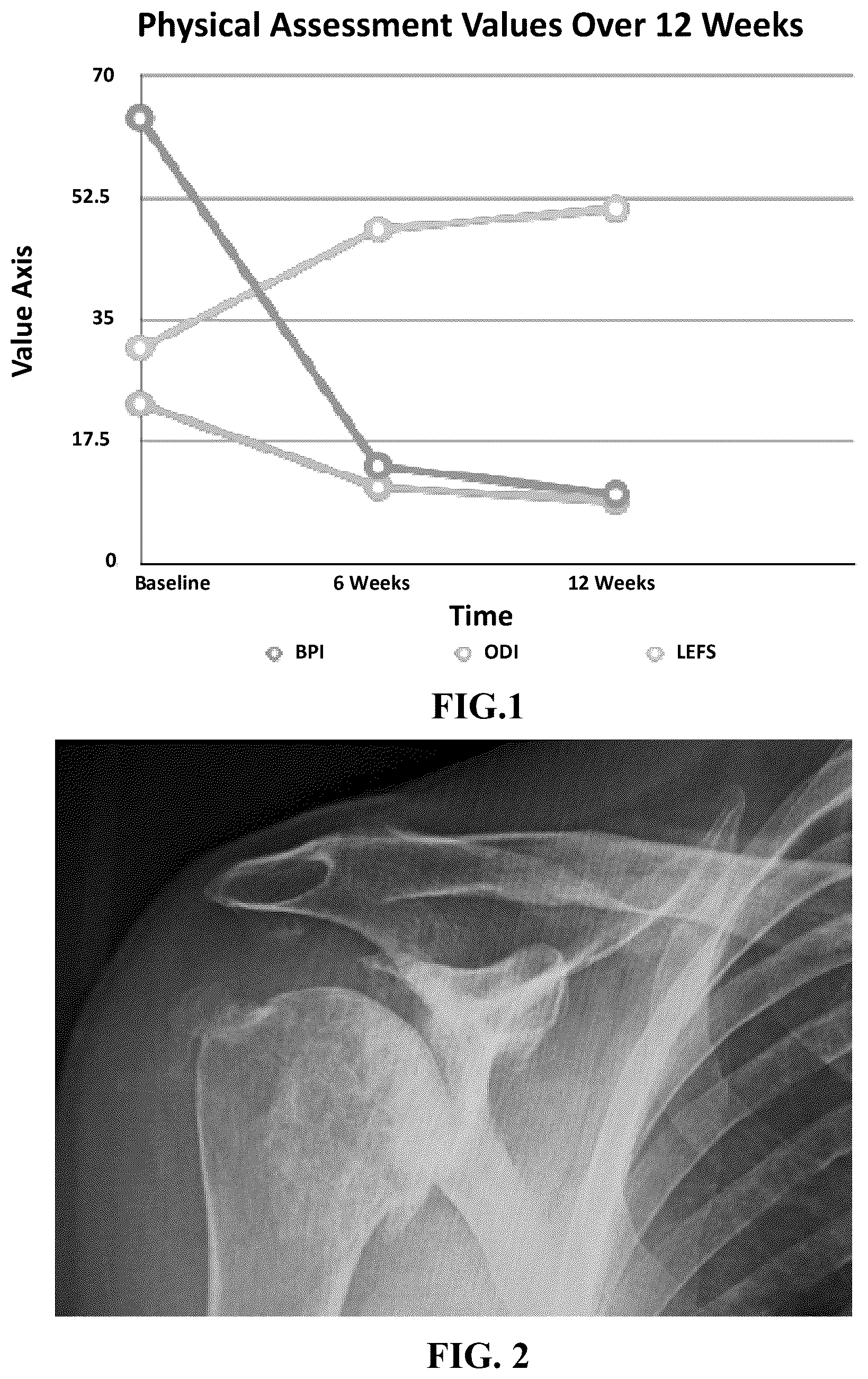 Patent US12569517 — Method for treating osteoarthritis with mesenchymal stem cell exosomes — Figure 1