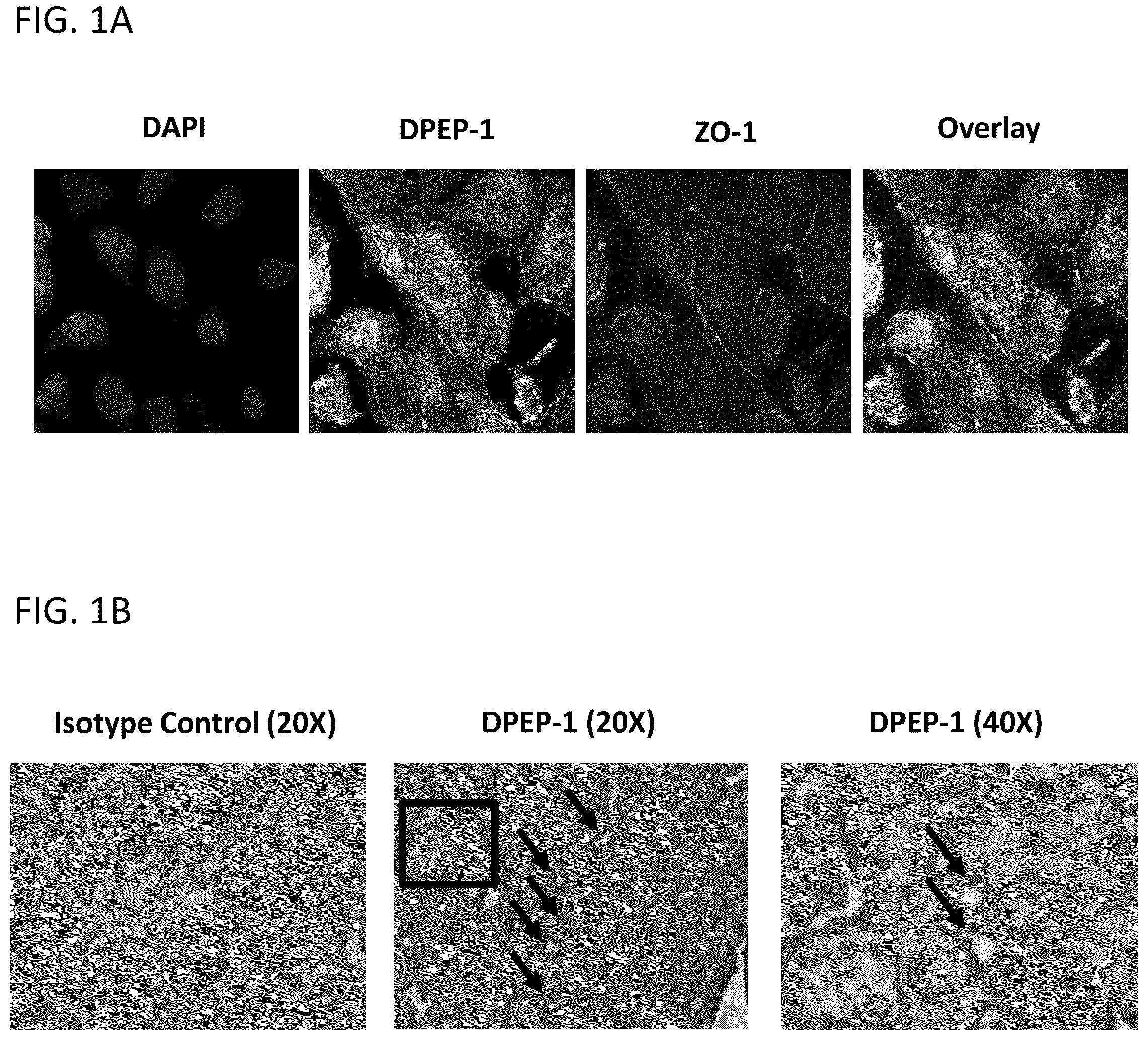 Patent US12569538 — DPEP-1 binding compositions and methods of use — Figure 1