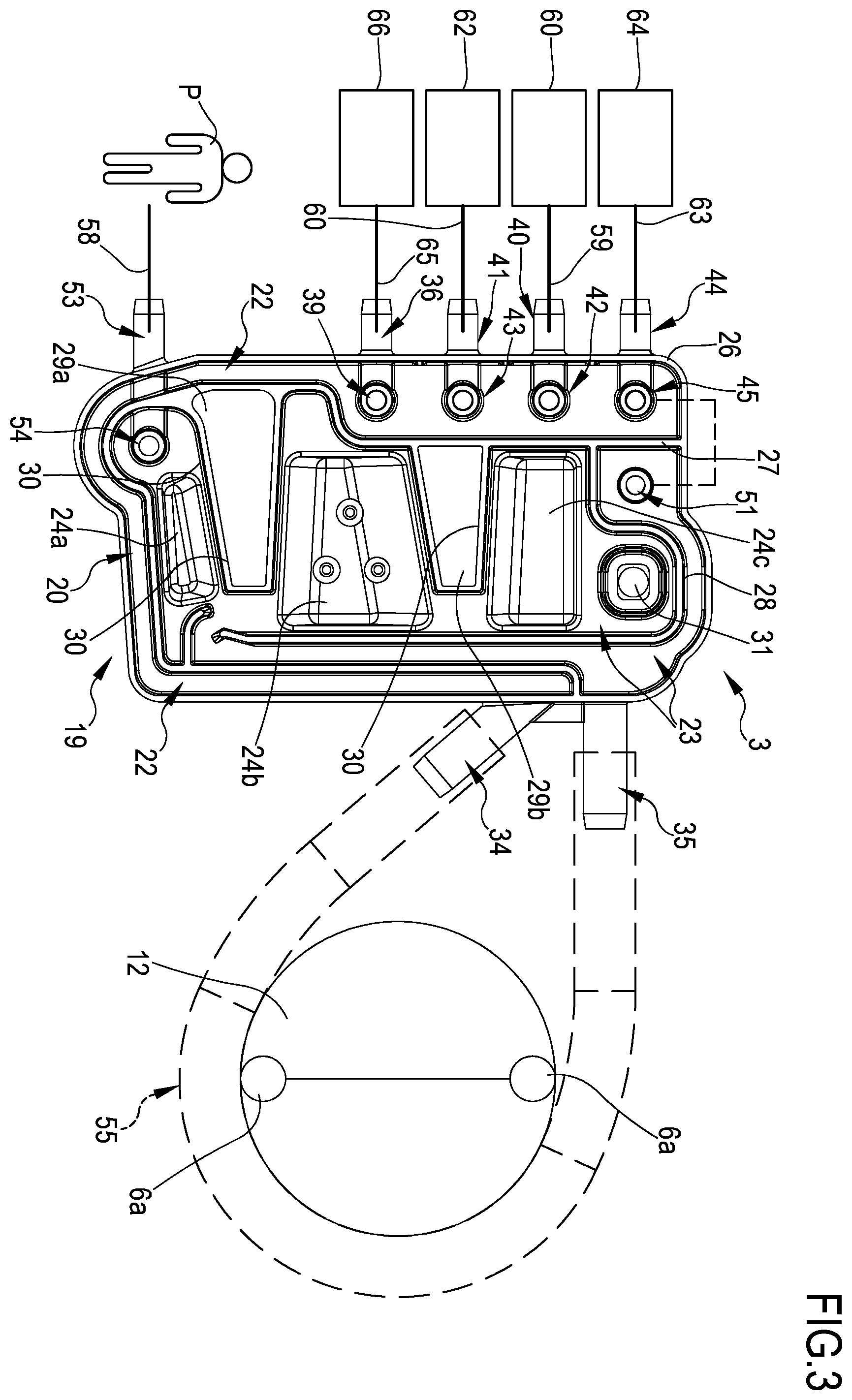 Patent US12569603 Figure 3 – Method for calibrating a peristaltic pump in a medical apparatus and medical apparatus for performing this method