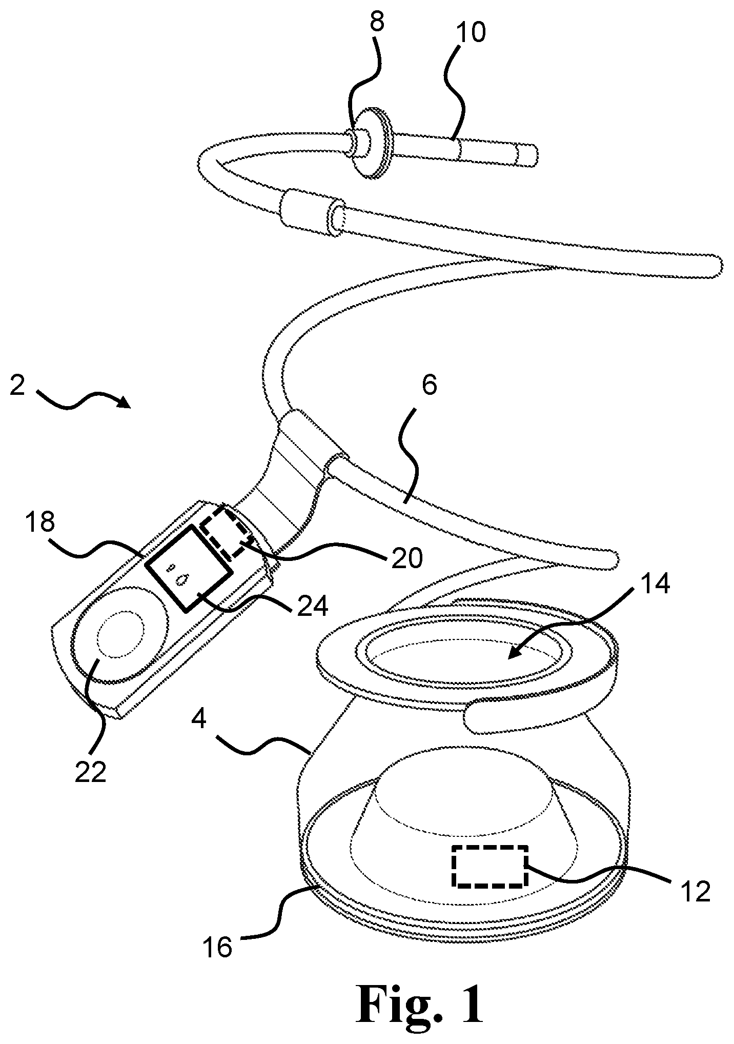 Patent US12569612 — Method for disinfecting an anal irrigation system — Figure 1