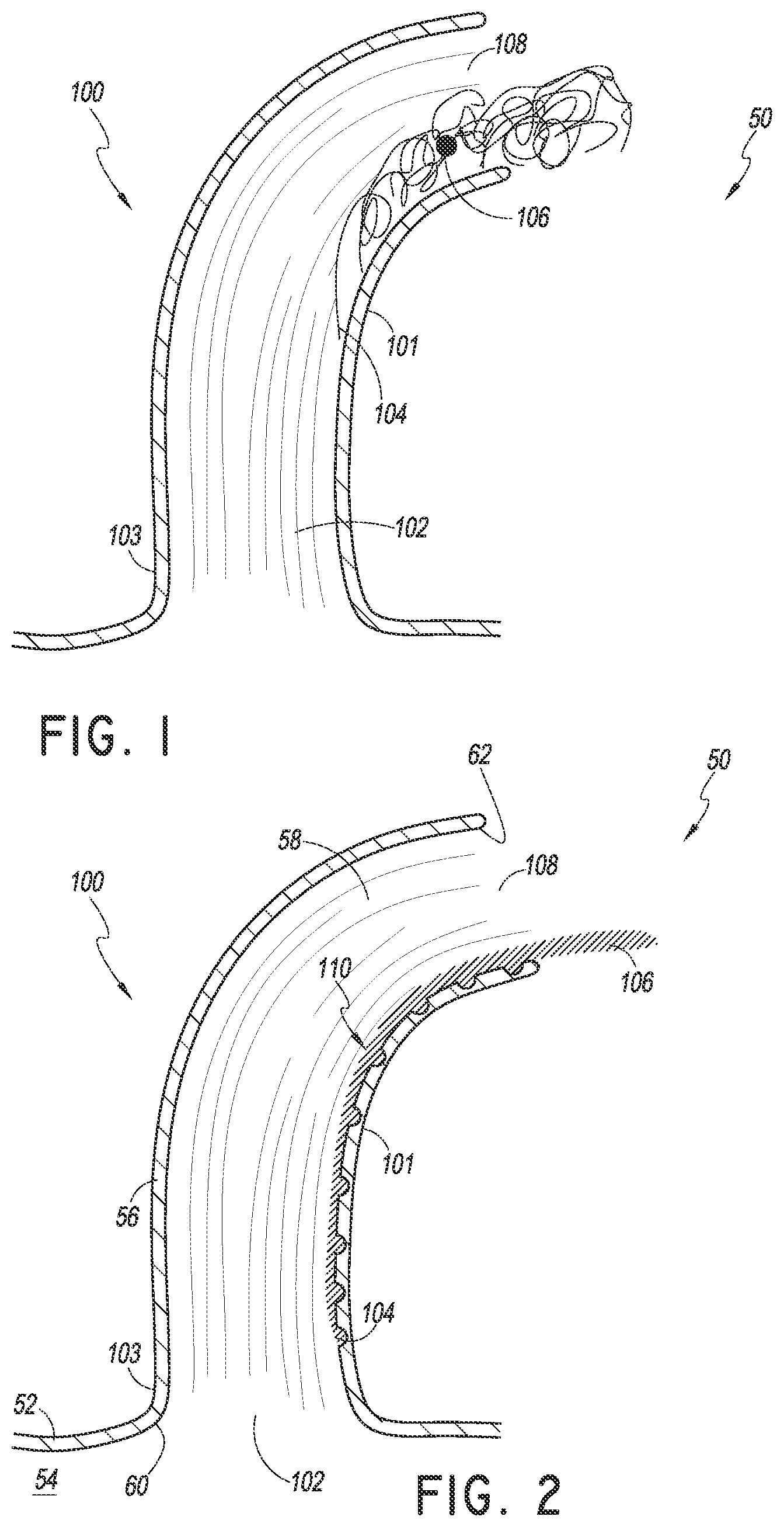 Patent US12569636 Figure 1 – Nasal cannula with turbulation elements