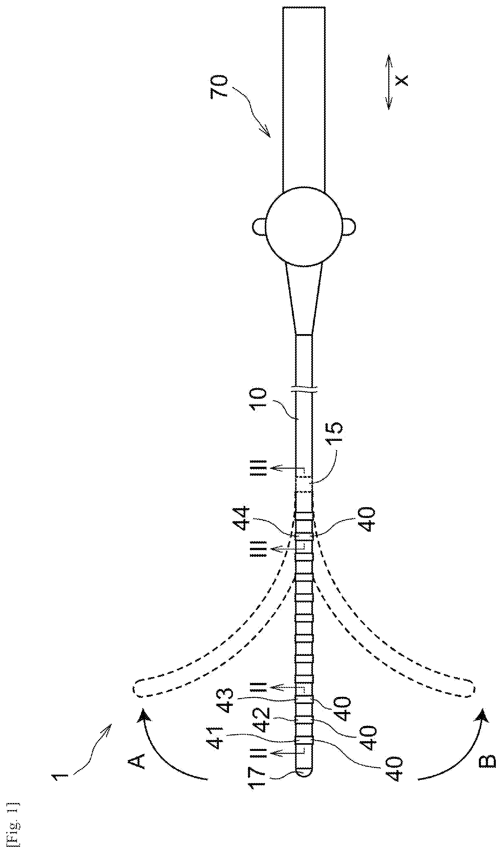 Patent US12569648 — Catheter and method for manufacturing catheter — Figure 1