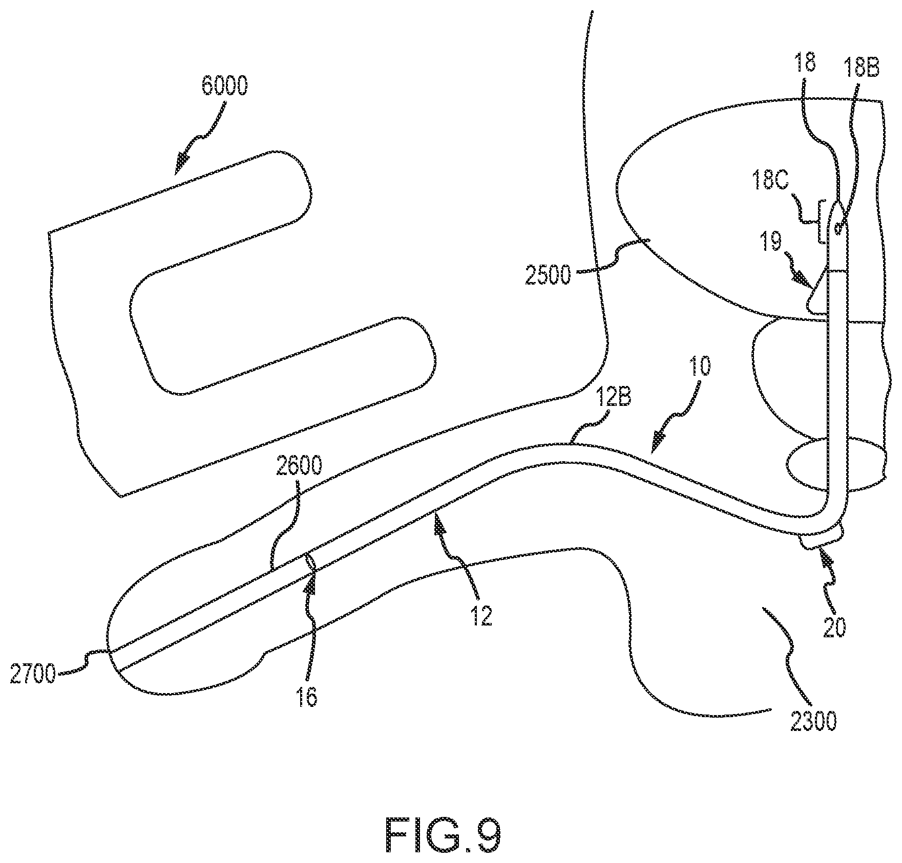 Patent US12569650 Figure 8 – Urinary catheter with retention features