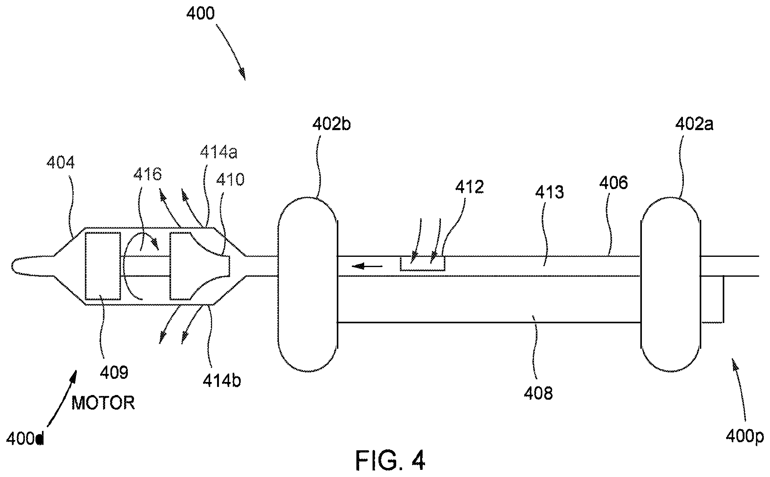 Patent US12569654 Figure 4 – Systems and methods for treatment of fluid overload