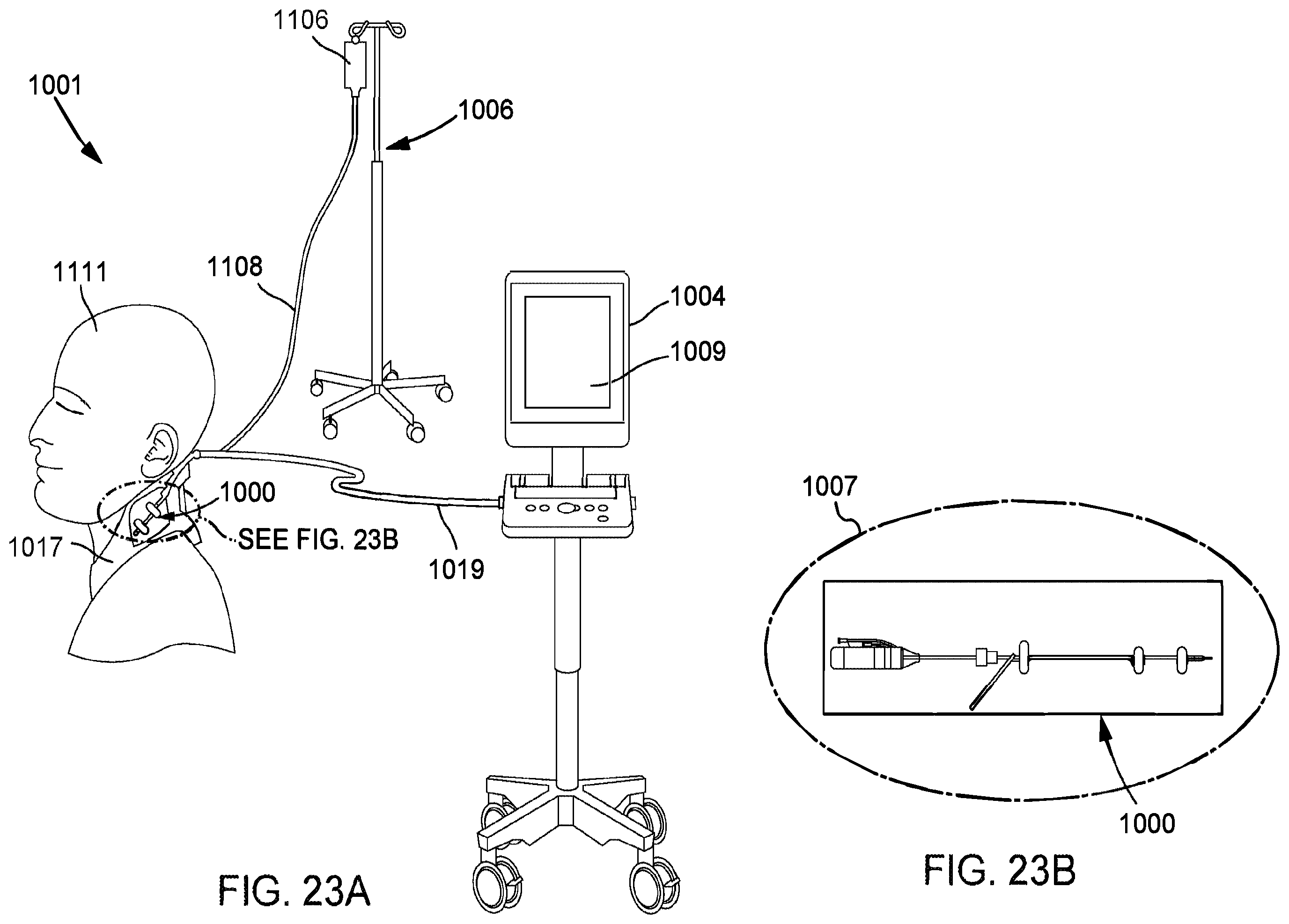 Patent US12569654 Figure 15 – Systems and methods for treatment of fluid overload
