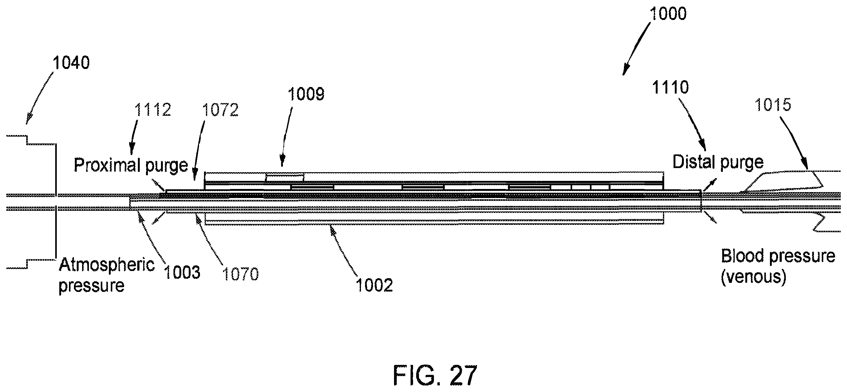 Patent US12569654 Figure 18 – Systems and methods for treatment of fluid overload