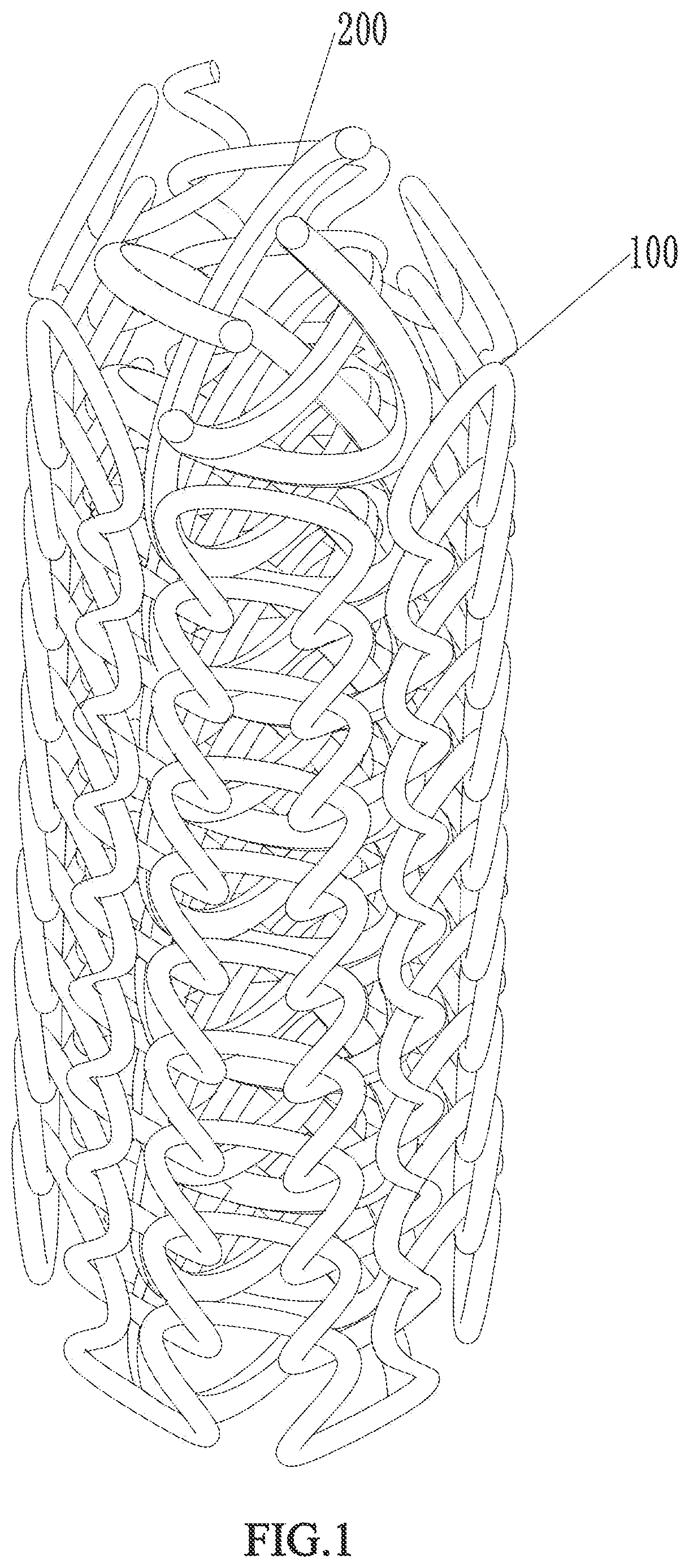 Patent US12569656 Figure 1 – Ureteral stent and manufacturing method thereof