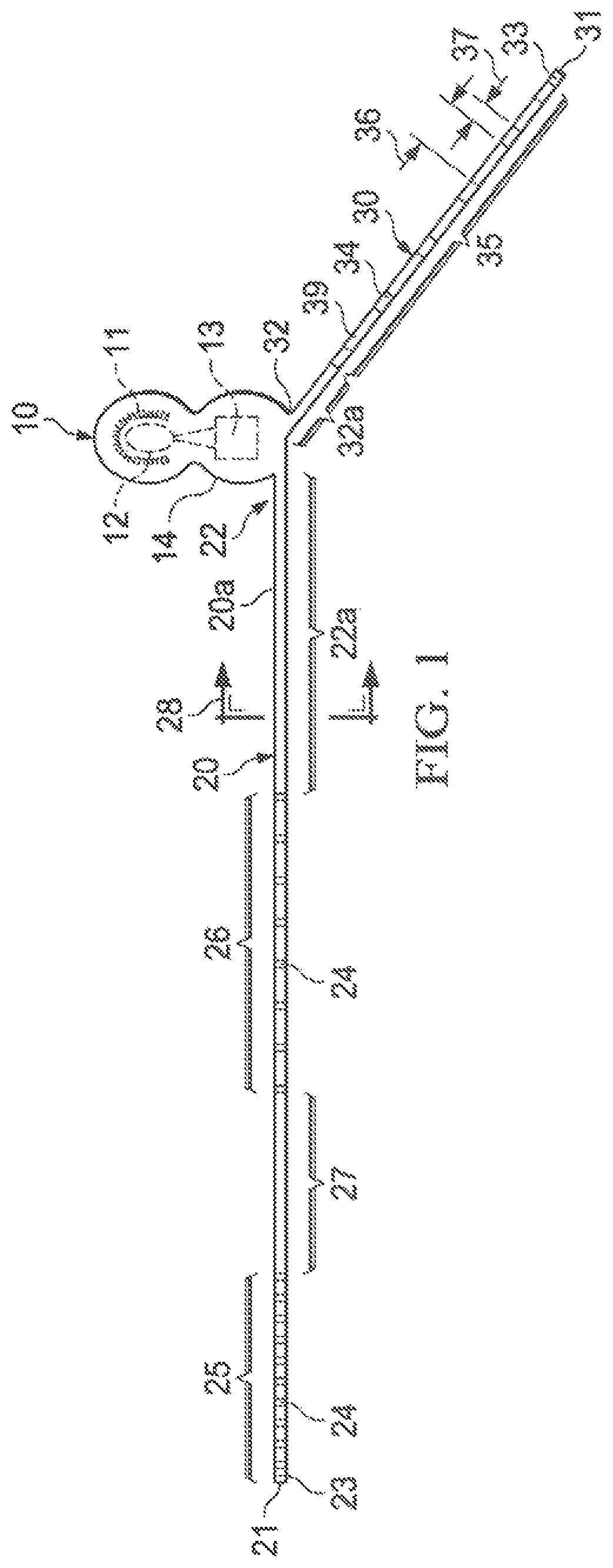 Patent US12569683 — Implantable head located radiofrequency coupled neurostimulation system for head pain — Figure 1