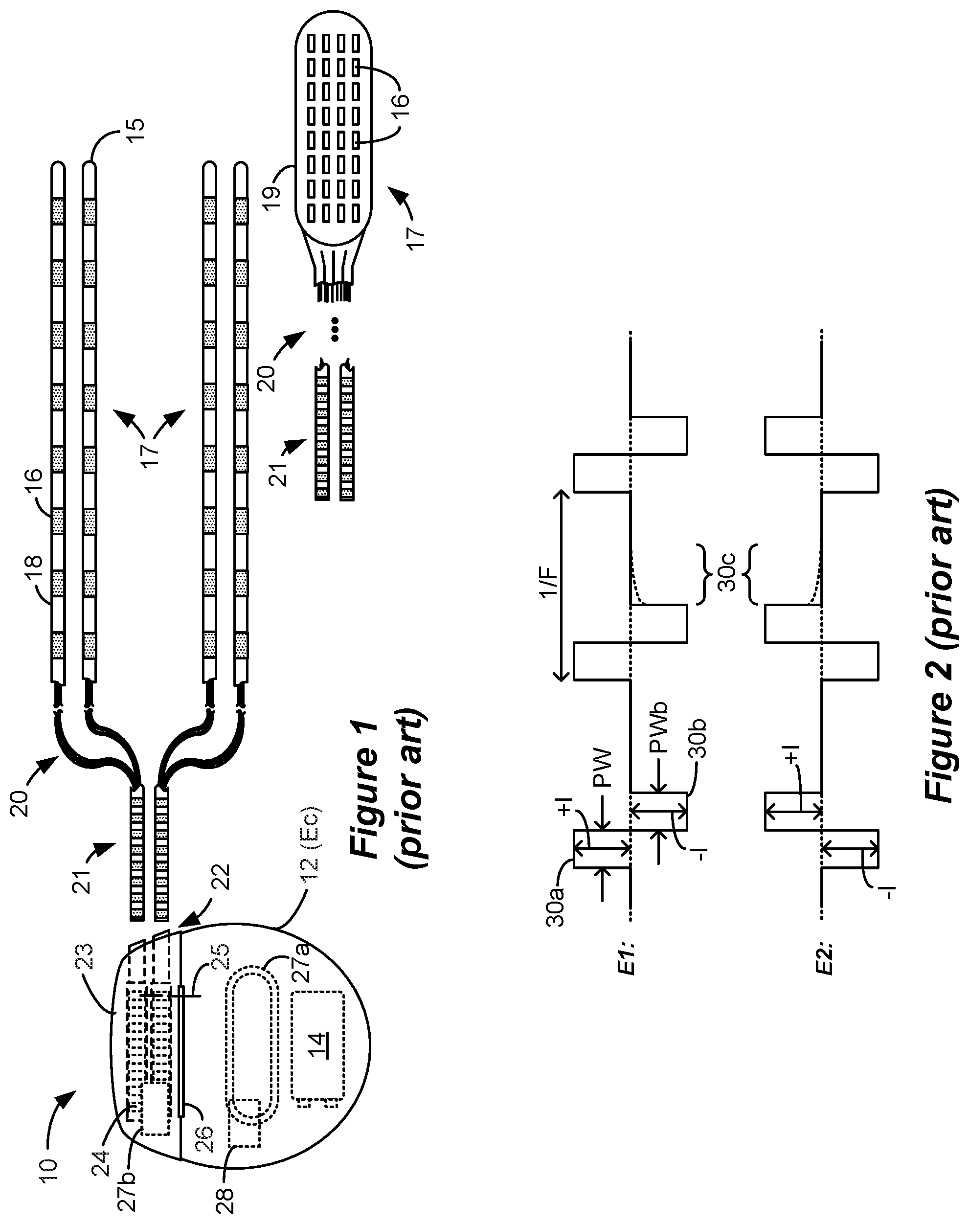 Patent US12569684 — Calibration of stimulation circuitry in an implantable stimulator device using sensed neural responses to stimulation — Figure 1