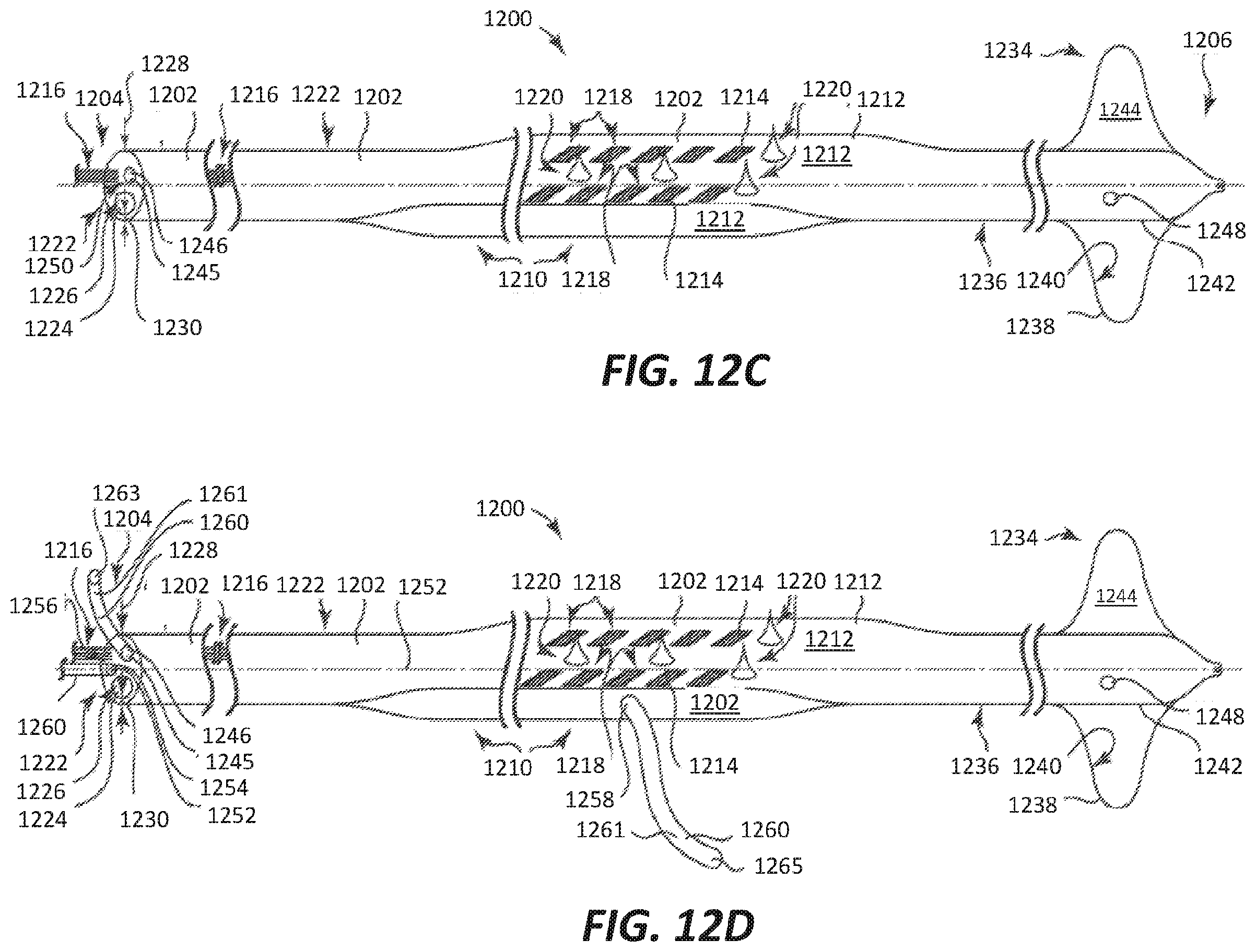 Patent US12569686 Figure 20 – Chronically implantable systems and methods for affecting cardiac contractility and/or relaxation