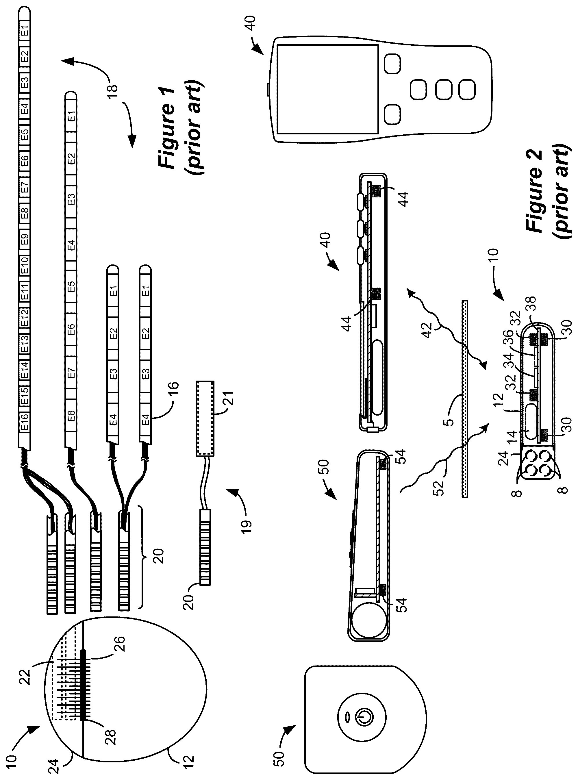 Patent US12569687 — System and method for determination of connected neurostimulation leads — Figure 1