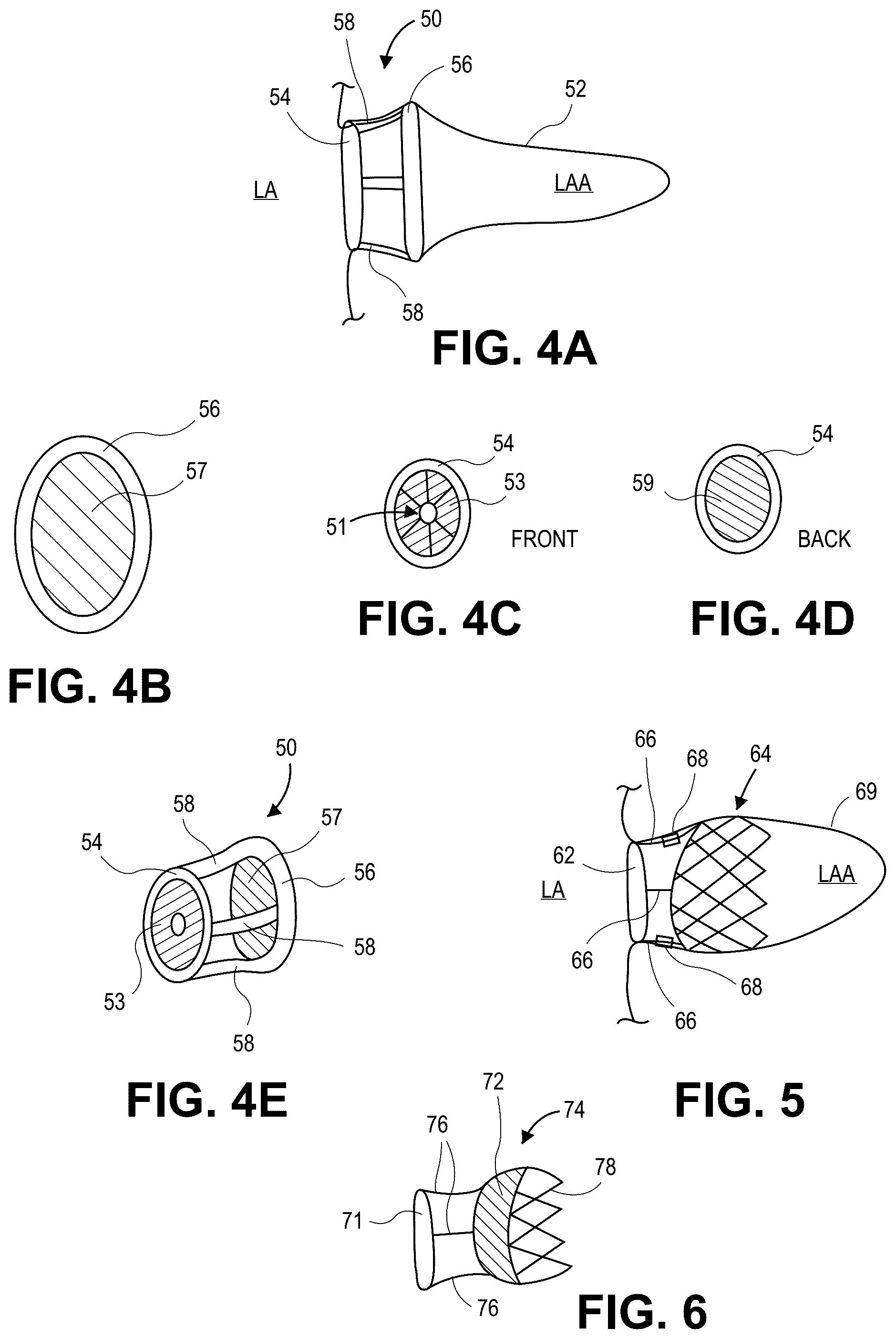 Patent US12569691 Figure 2 – Atrial appendage occlusion and arrhythmia tratment