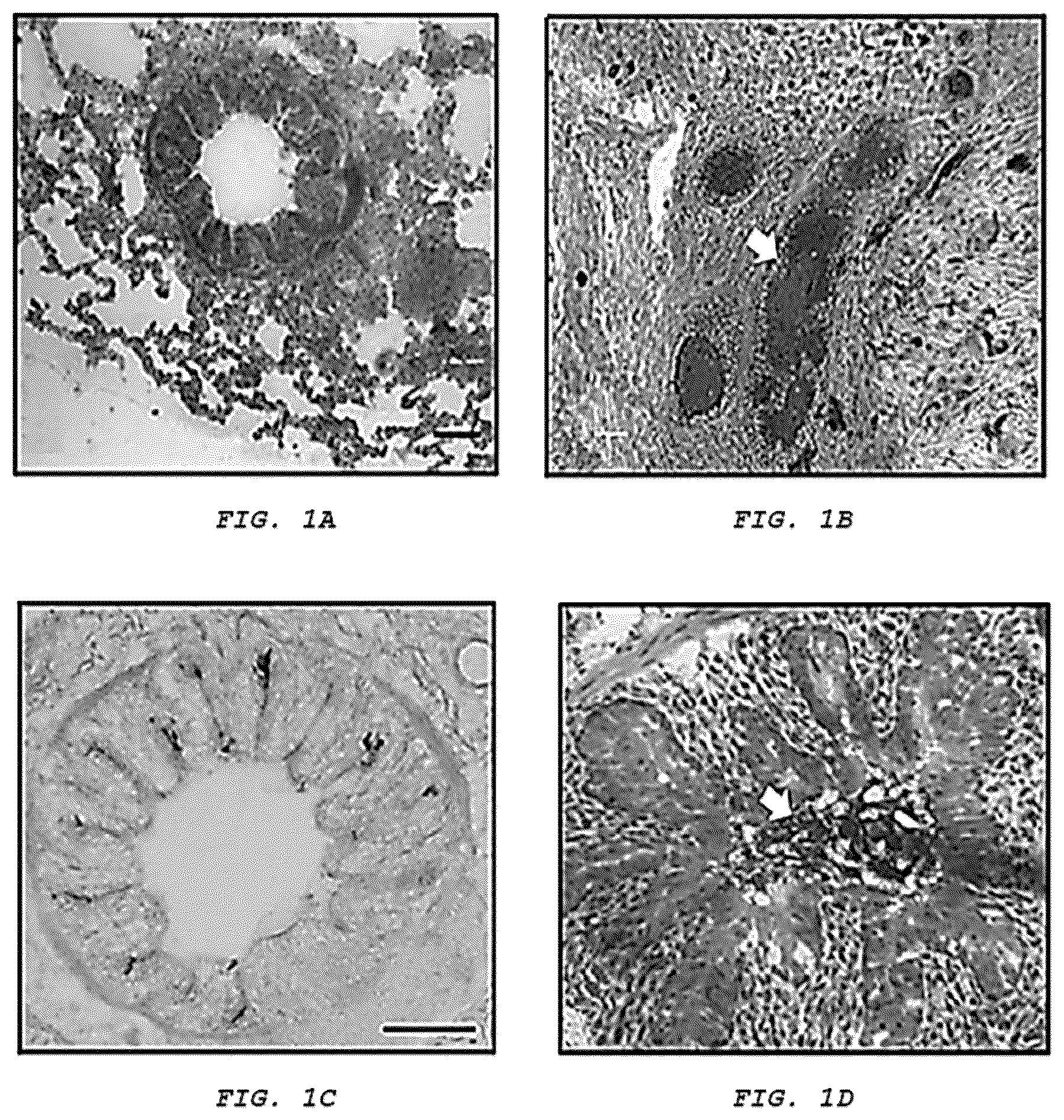 Patent US12576051 Figure 1 – Methods and composition for treating respiratory obstructive diseases