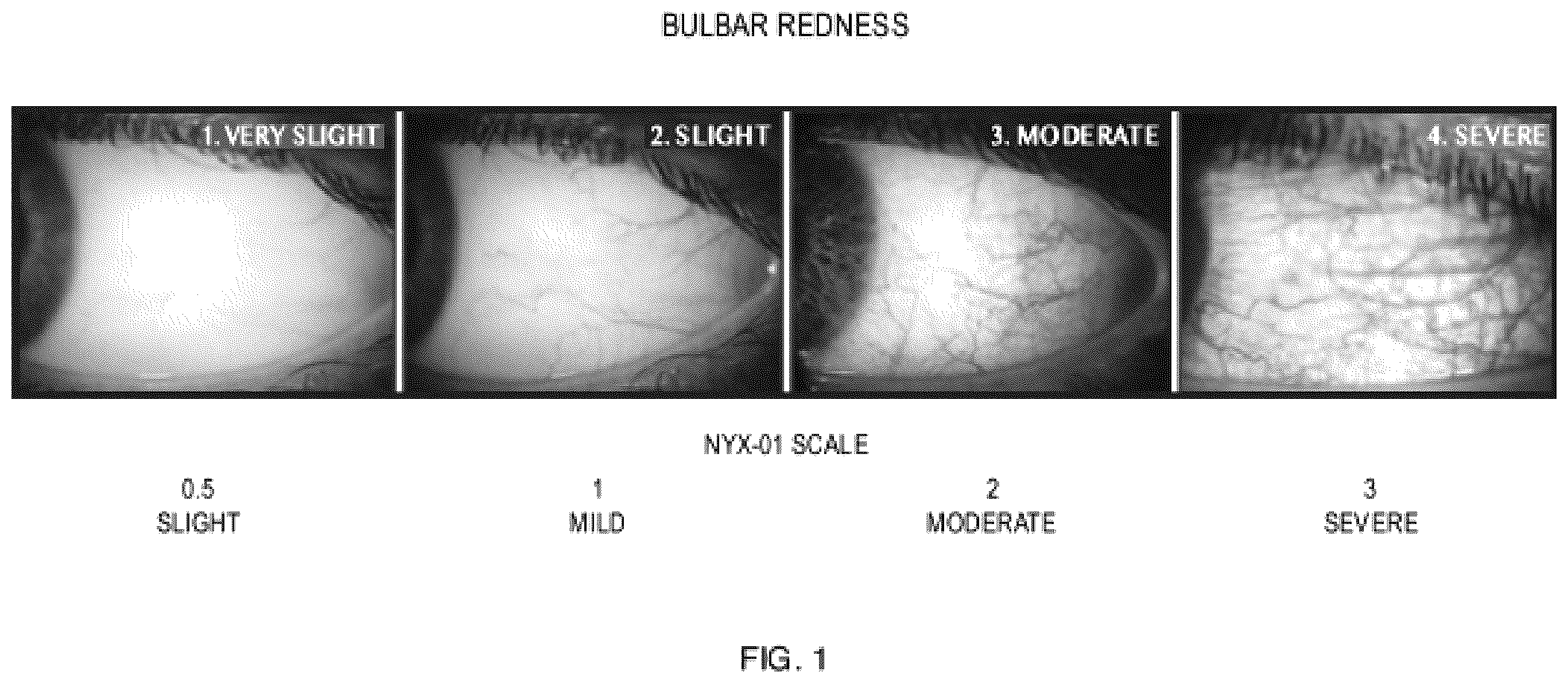 Patent US12576067 Figure 1 – Methods and compositions for treatment of mydriasis