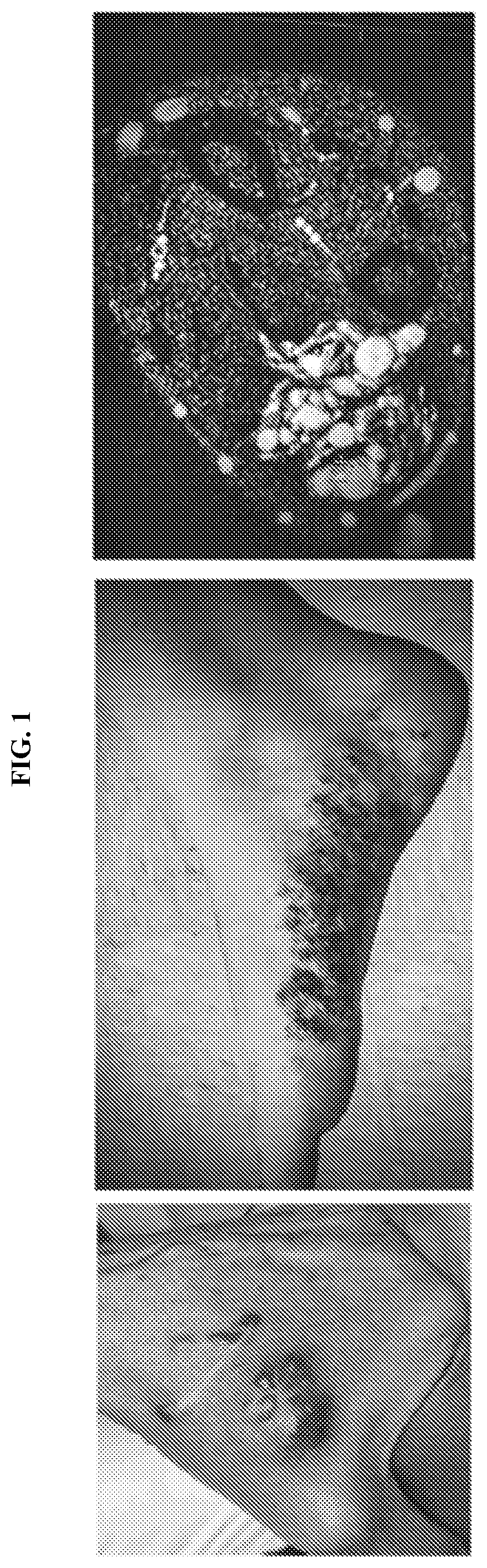 Patent US12576069 — Compositions and methods for treating slow-flow vascular malformations — Figure 1