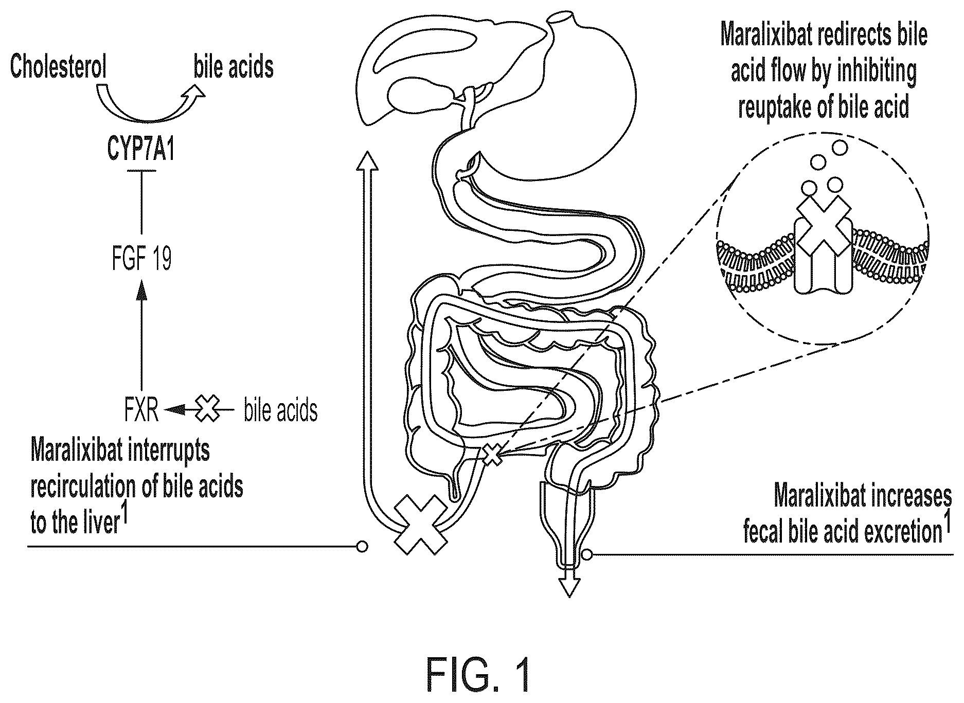 Patent US12576079 — Methods for treating cholestasis — Figure 1