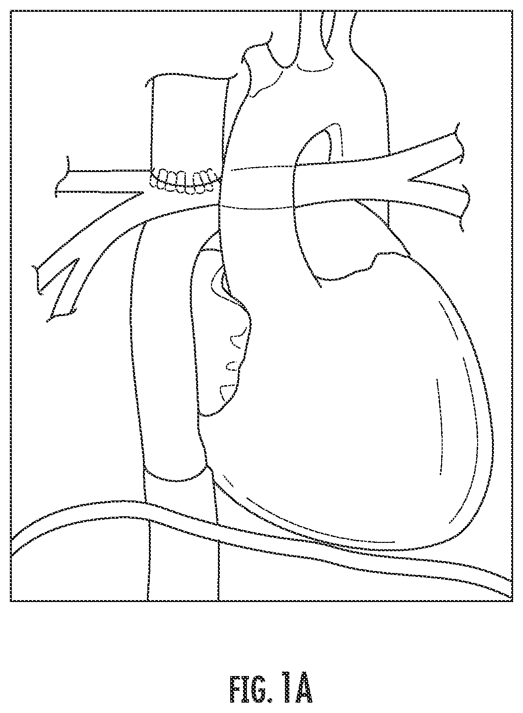Patent US12576081 Figure 1 – Methods and compositions for improving exercise performance, single ventricular performance, cardiac output and myocardial performance index (MPI) in single ventricular heart disease, using udenafil compositions