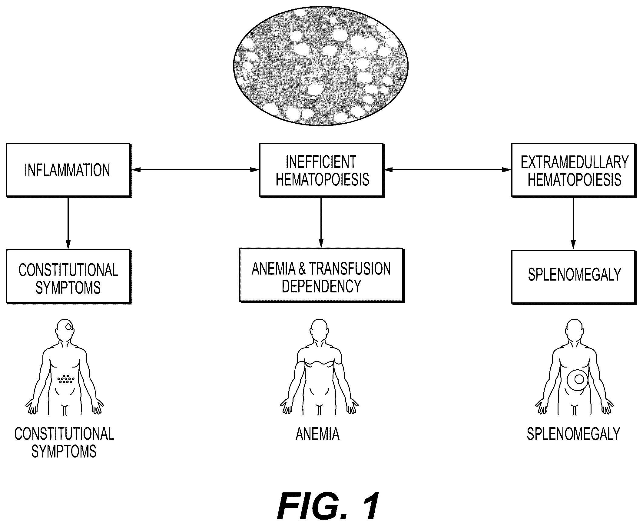 Patent US12576089 — Platelet count-agnostic methods of treating myelofibrosis — Figure 1