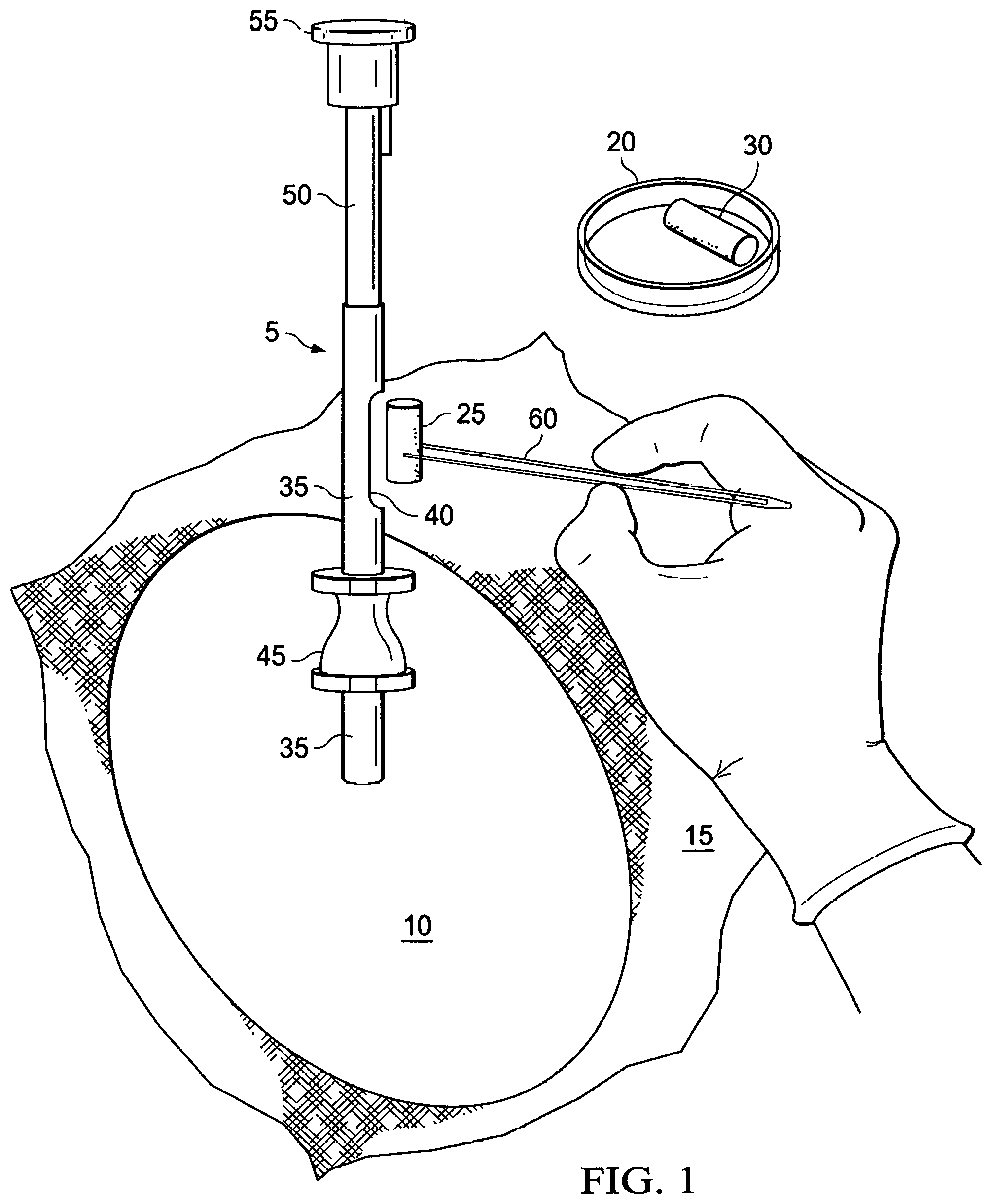 Patent US12576186 Figure 1 – Collagen pellet and methods for making and use