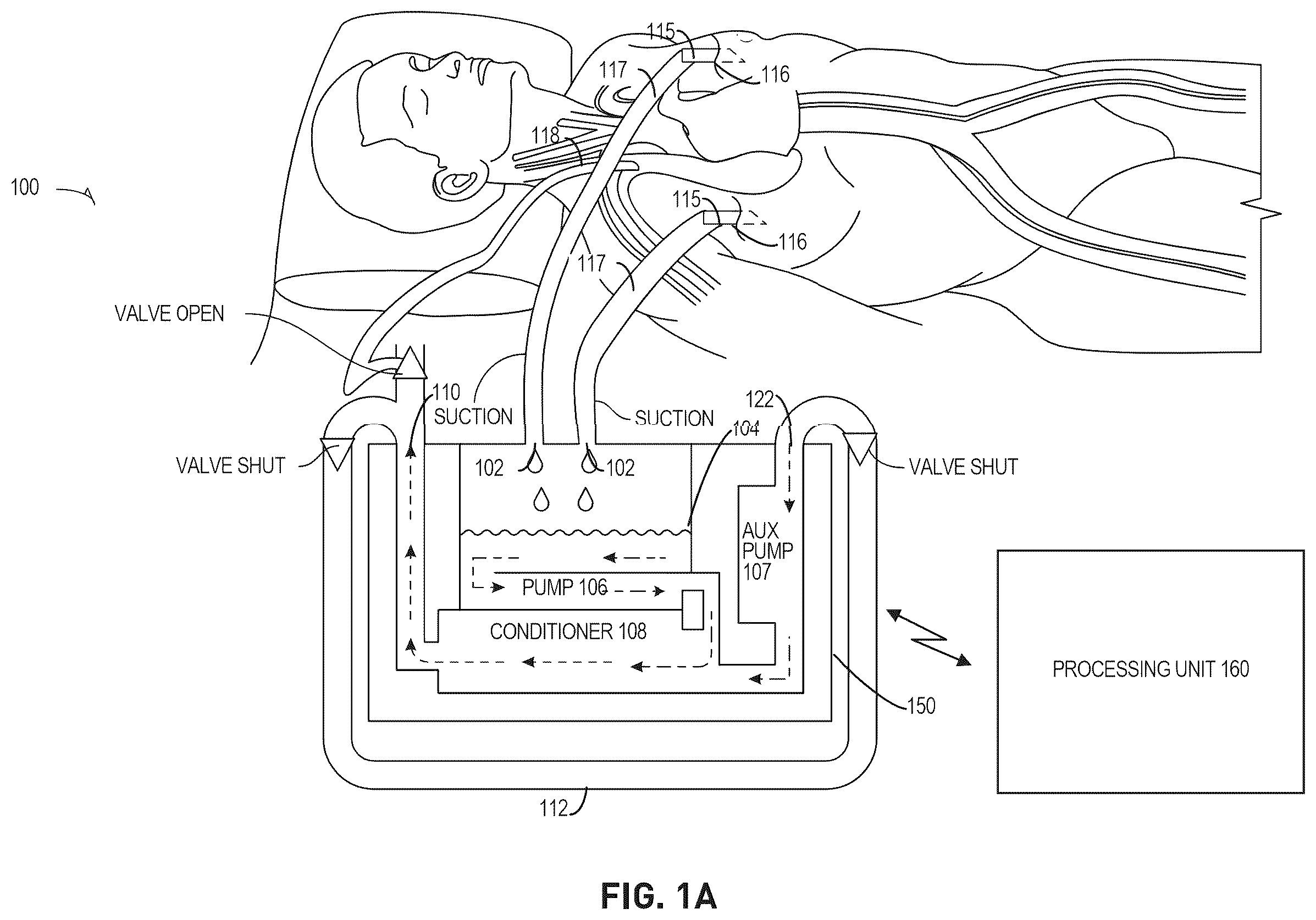 Patent US12576198 — Trauma patient hemorrhage control including rapid autotransfusion — Figure 1