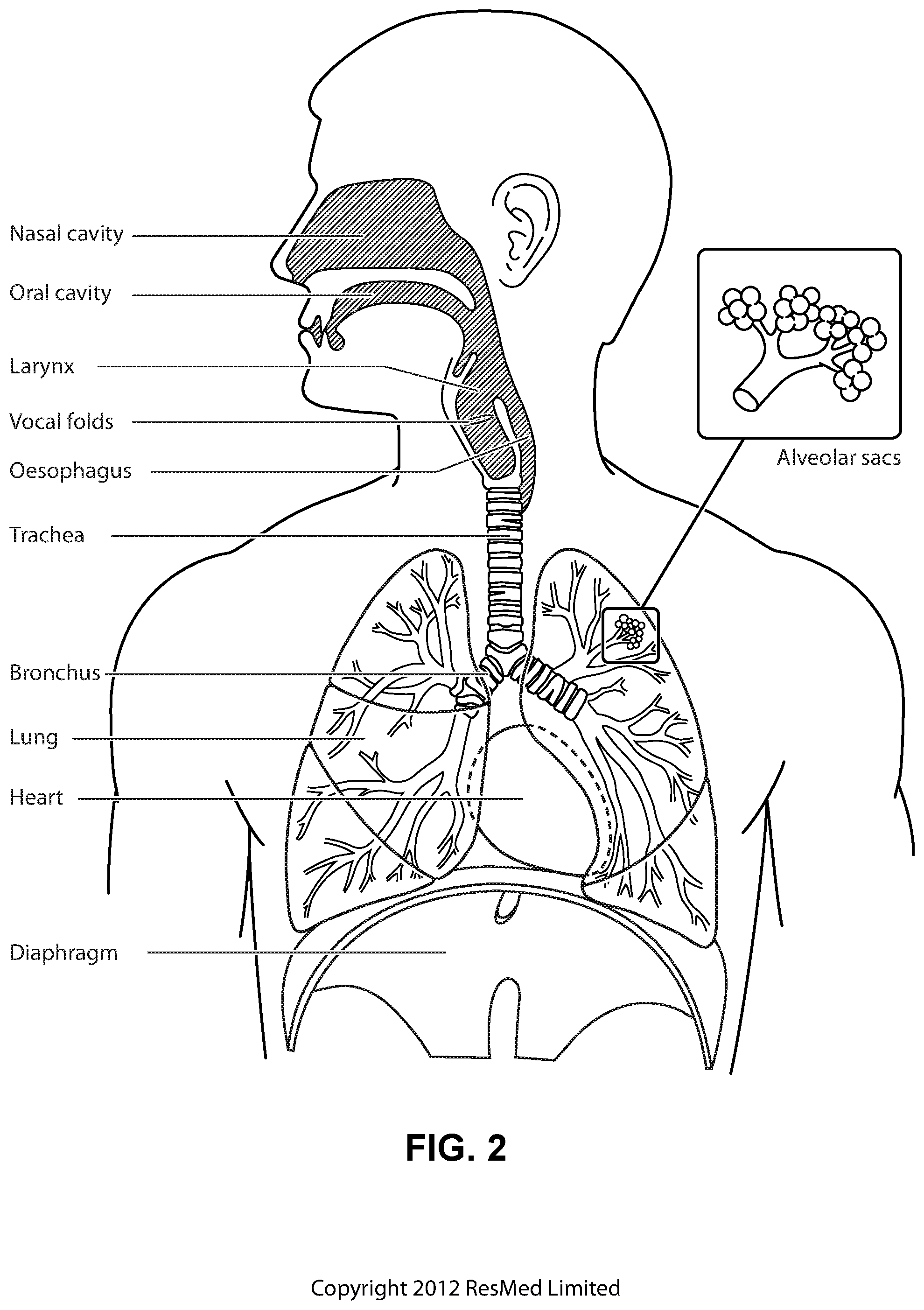 Patent US12576226 Figure 4 – Characterising systems for respiratory therapy