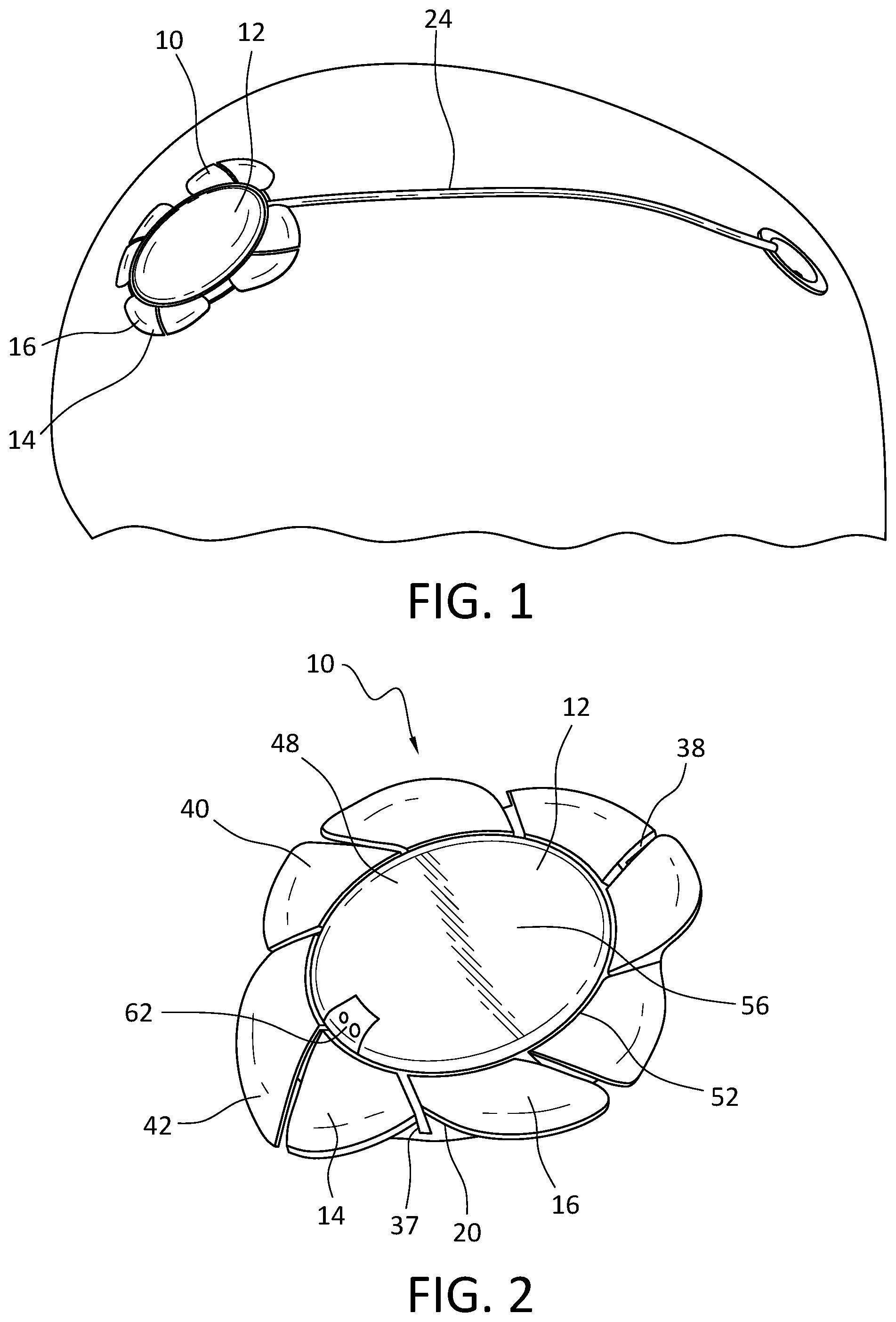 Patent US12576266 Figure 1 – Cranial implant with wire management structure