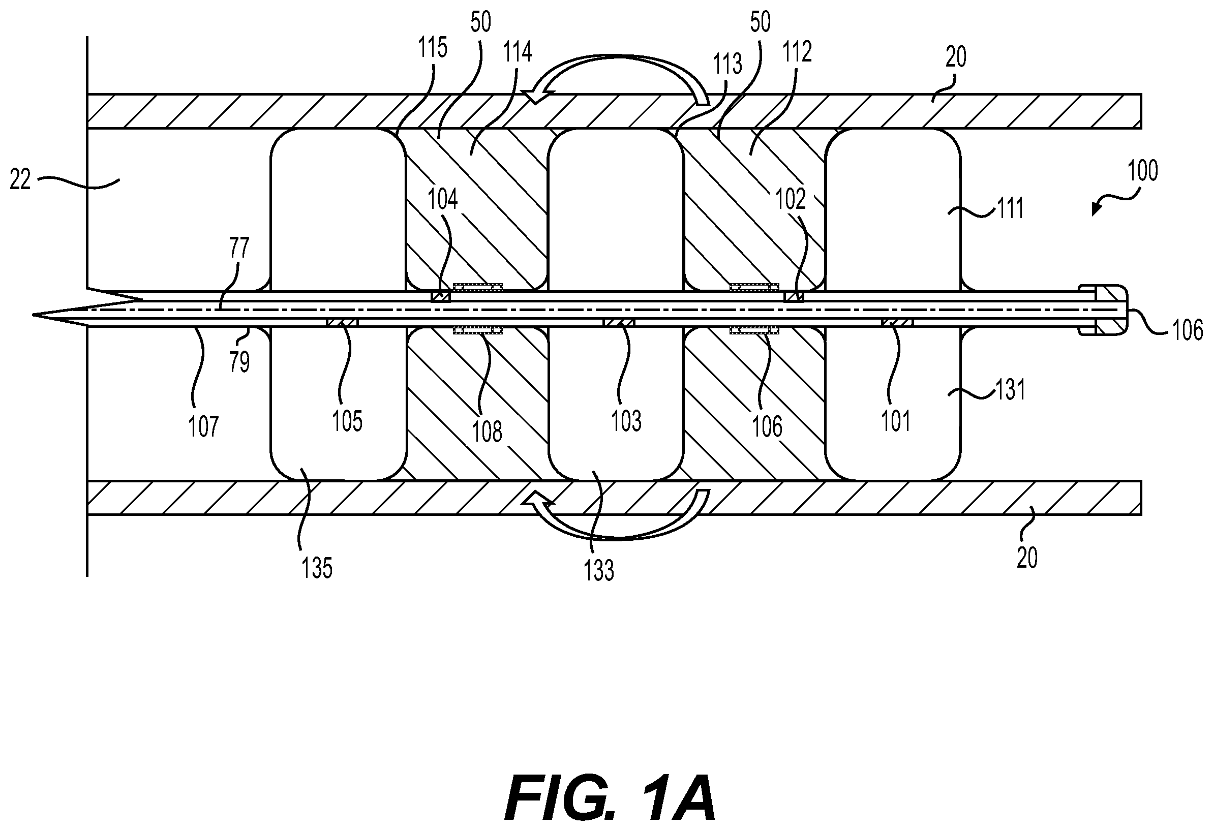 Patent US12576270 — Medical devices for electroporation — Figure 1