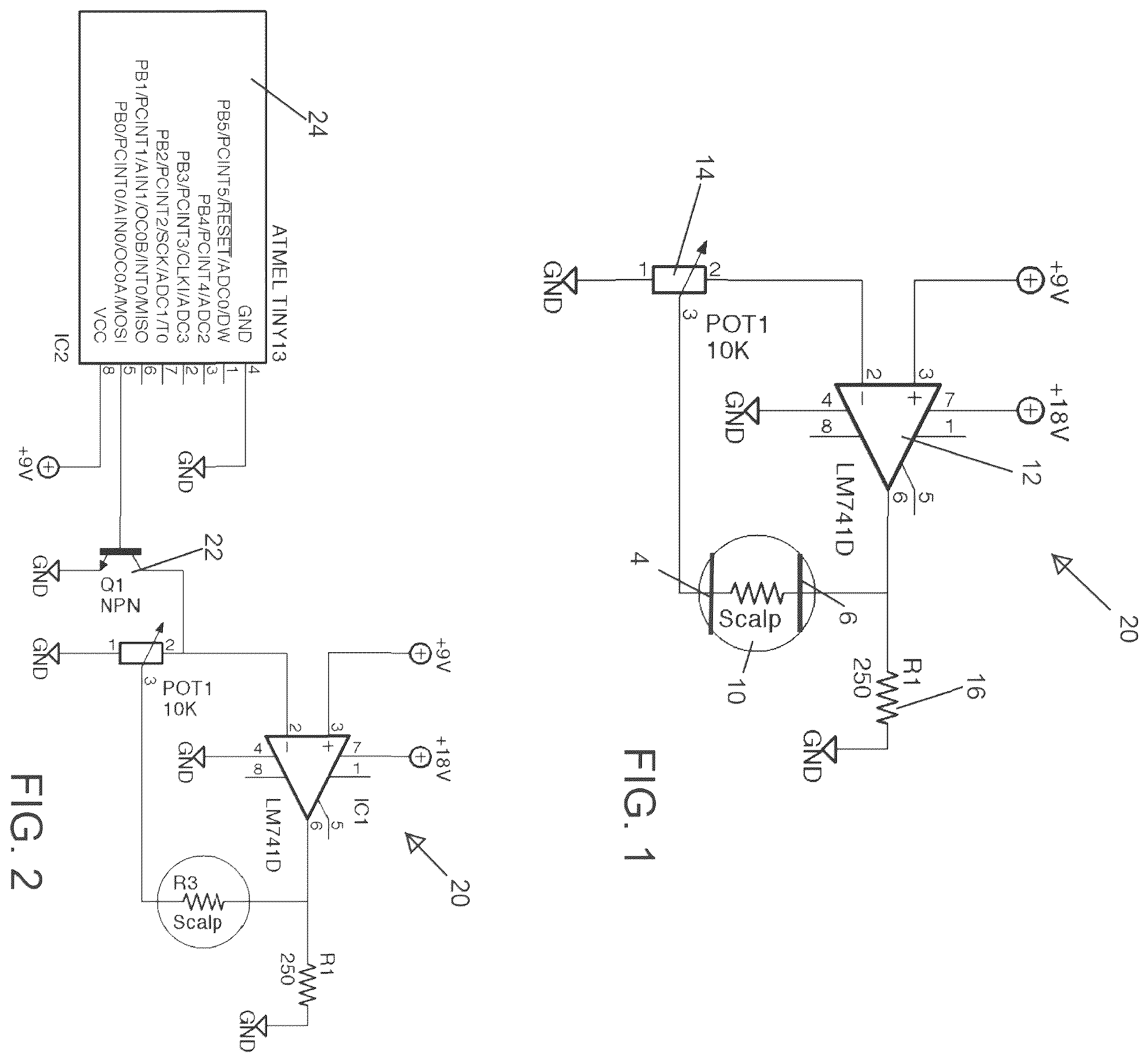 Patent US12576271 Figure 1 – Systems, devices and methods for anxiety treatment using vestibular nerve stimulation