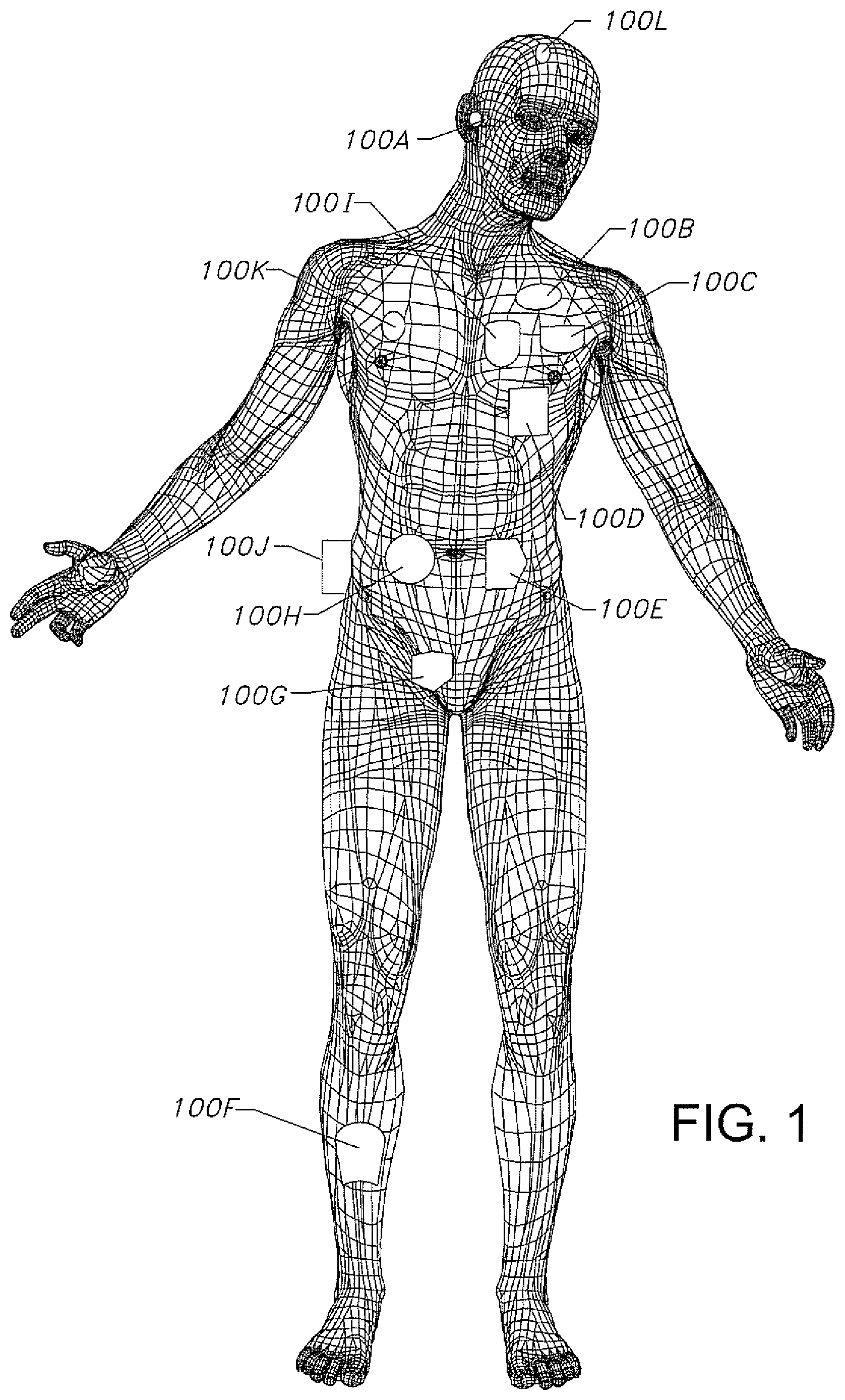 Patent US12576280 — Active medical device having a terminal housing assembly connected to a printed circuit board assembly without an intermediate feedthrough — Figure 1