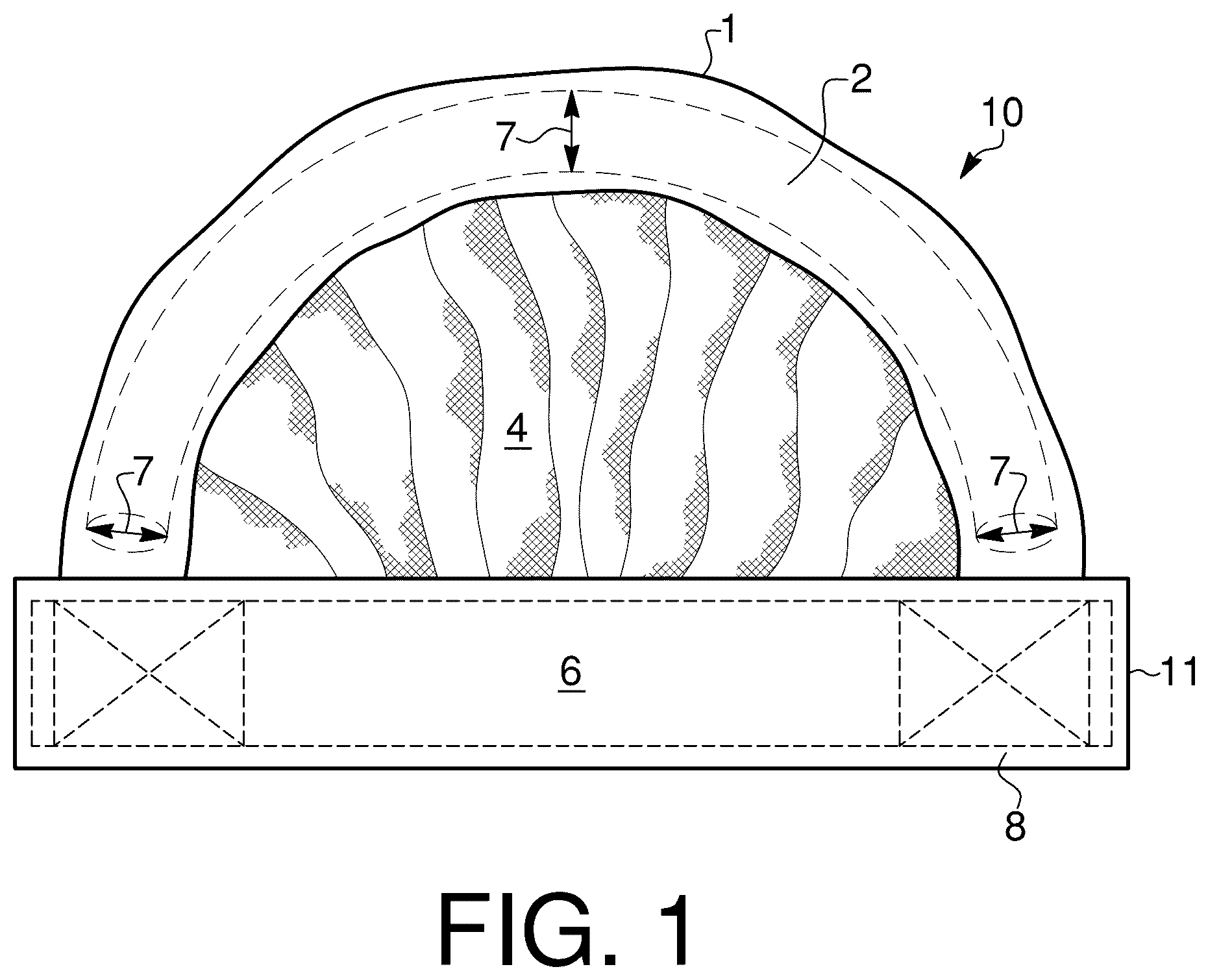 Patent US12576949 — User handle for watersports device — Figure 1