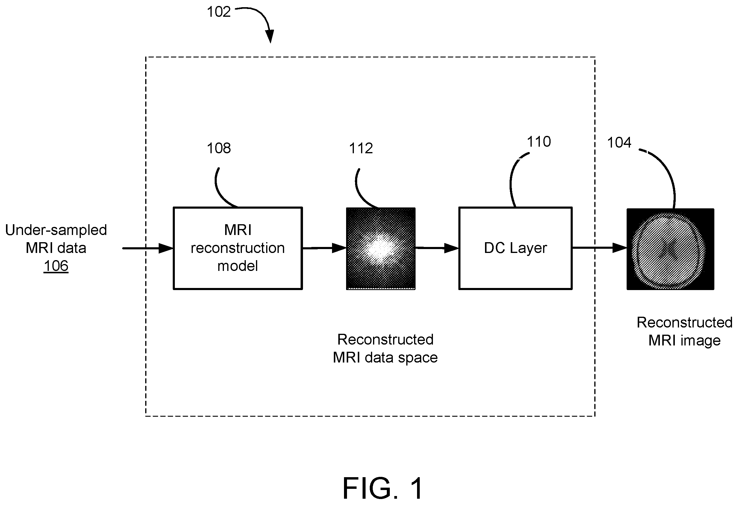 Patent US12579716 — MRI reconstruction based on contrastive learning — Figure 1