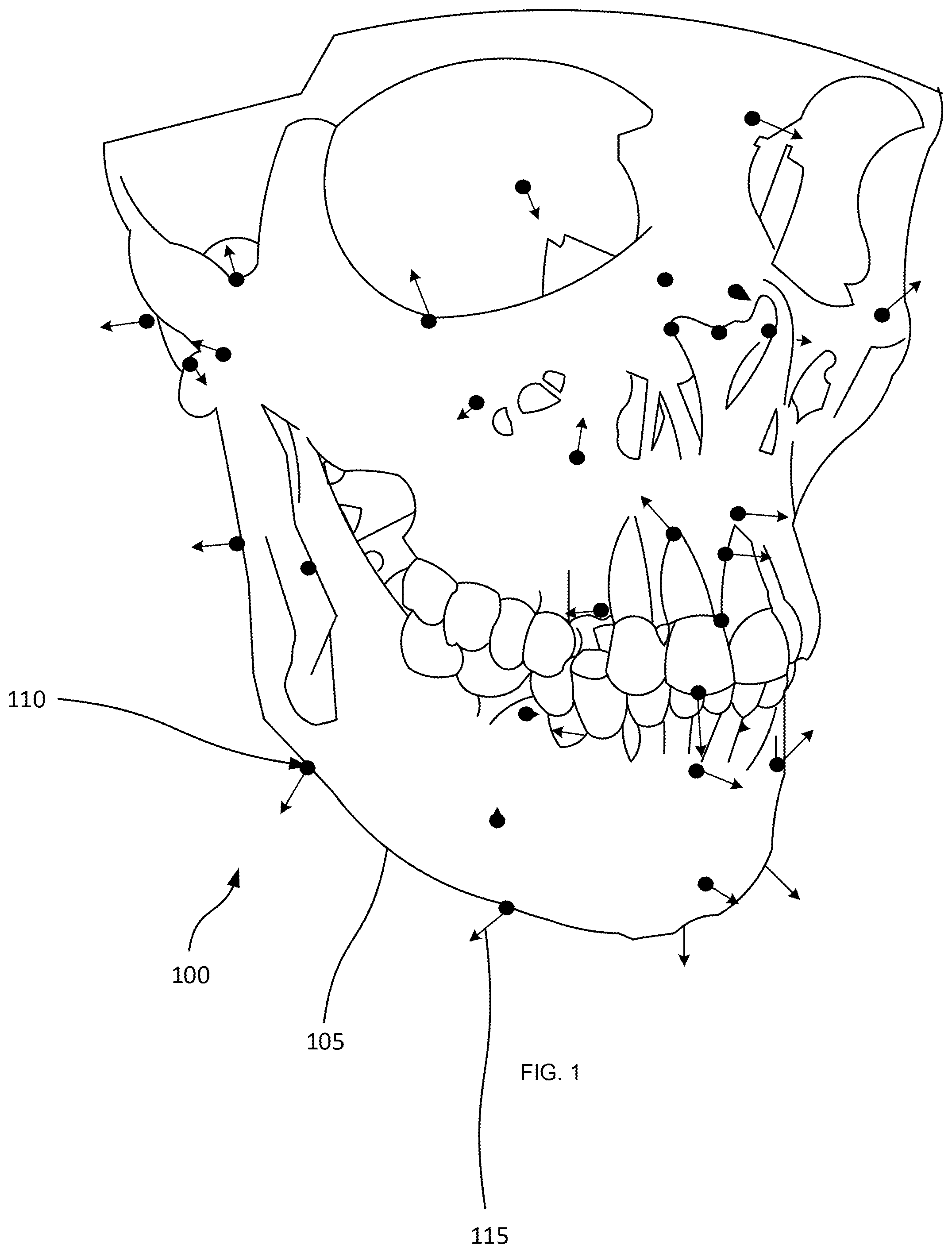 Patent US12579769 — Mapping and segmentation of oral maxillofacial complex and extracting clinical data — Figure 1