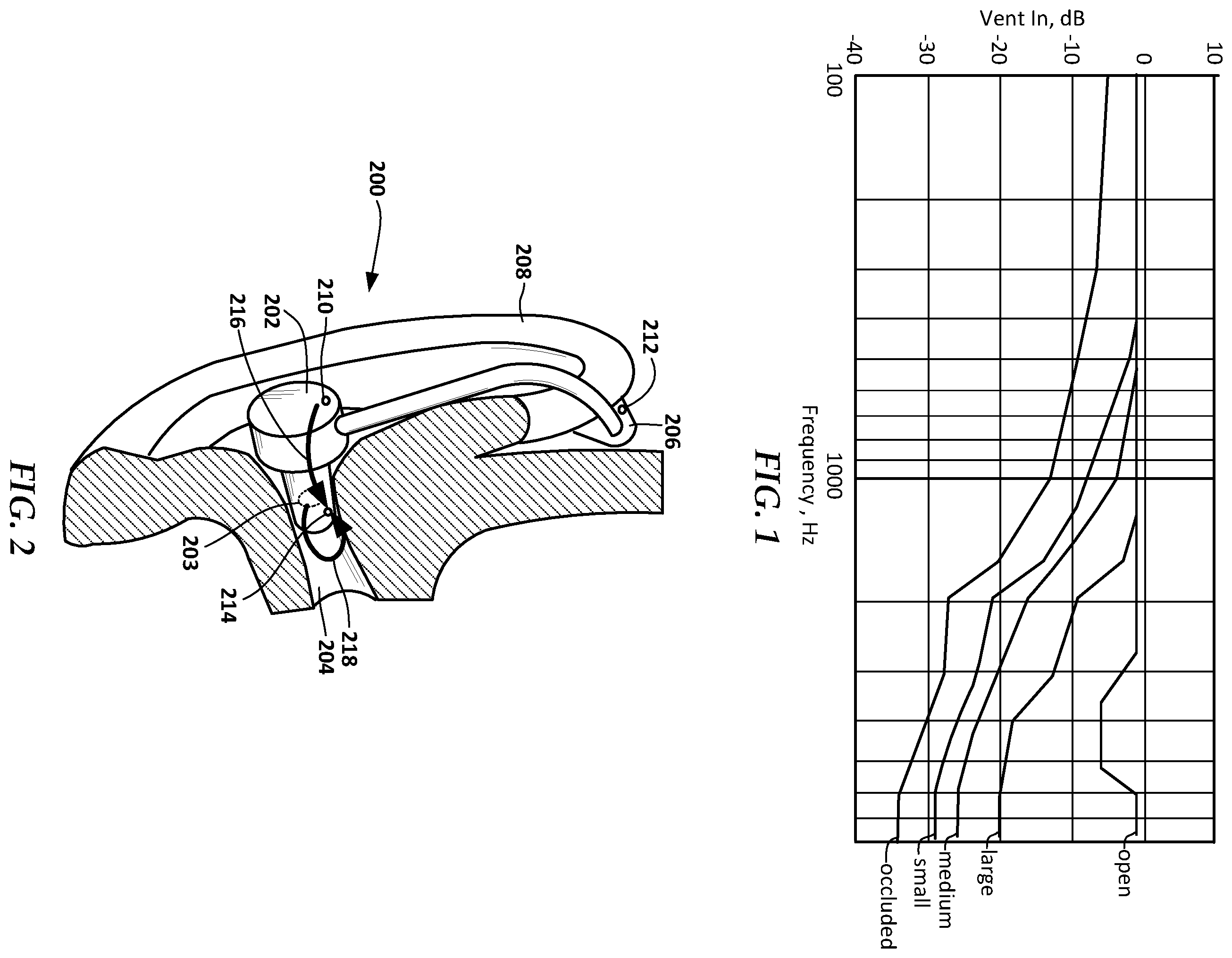 Patent US12581226 — Ear-wearable device with active noise cancellation system that uses internal and external microphones — Figure 1