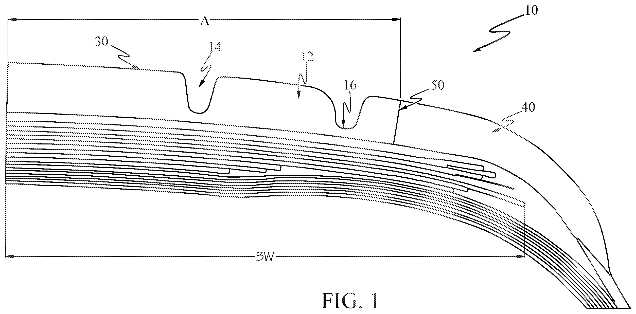 Patent US12583261 Figure 1 – Aircraft tire with zoned tread