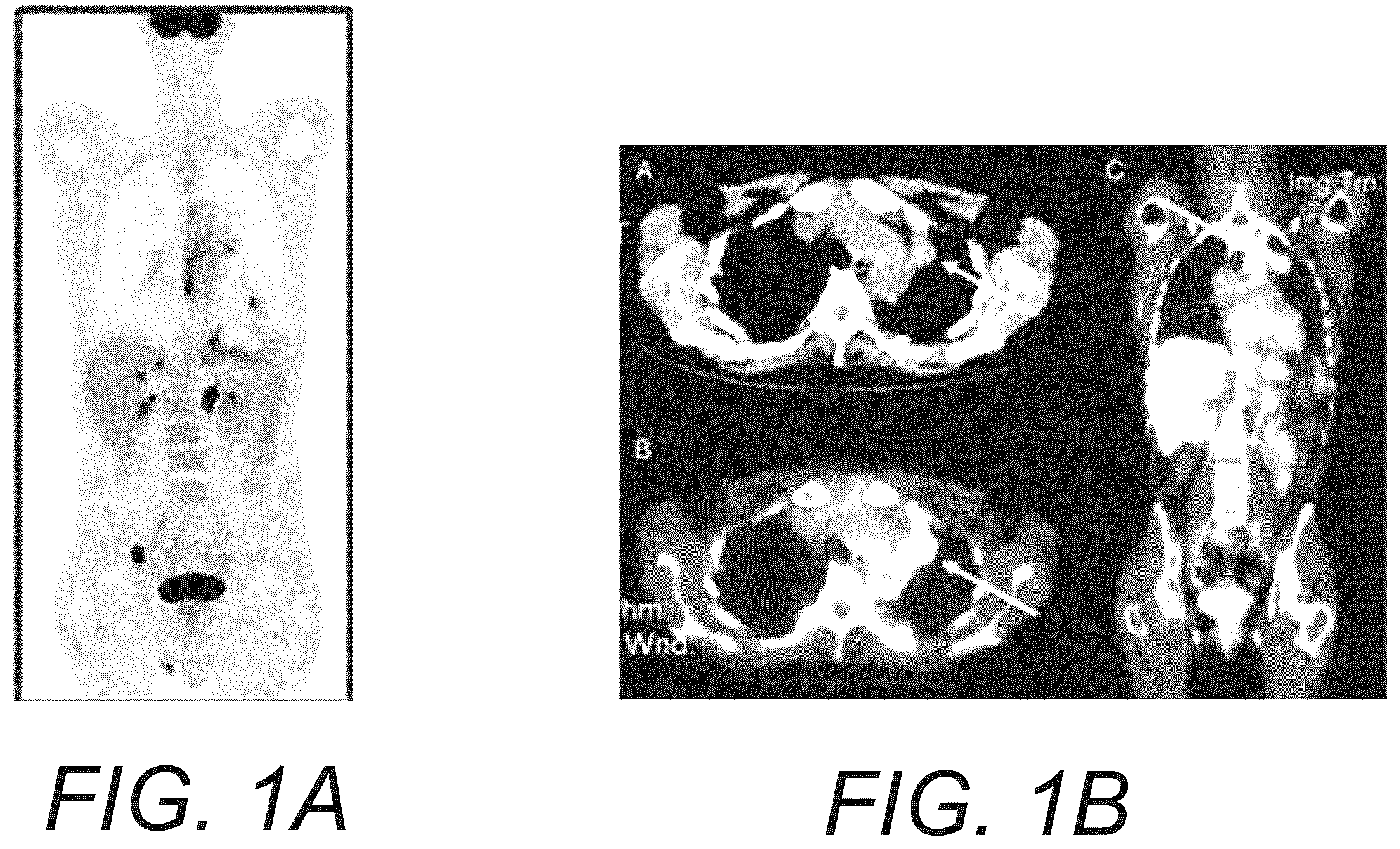Patent US12586181 — Functional imaging features from computed tomography images — Figure 1