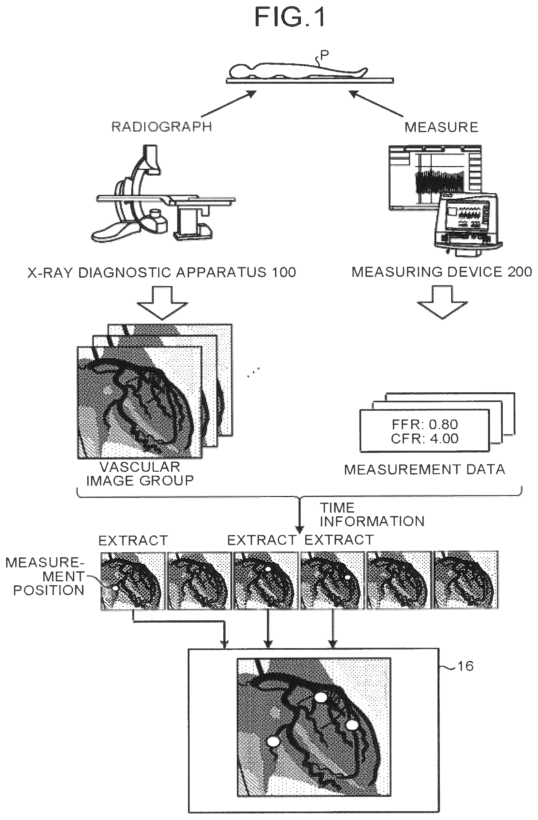 Patent US12586191 — Image processing apparatus, medical image diagnostic apparatus, and blood pressure monitor — Figure 1