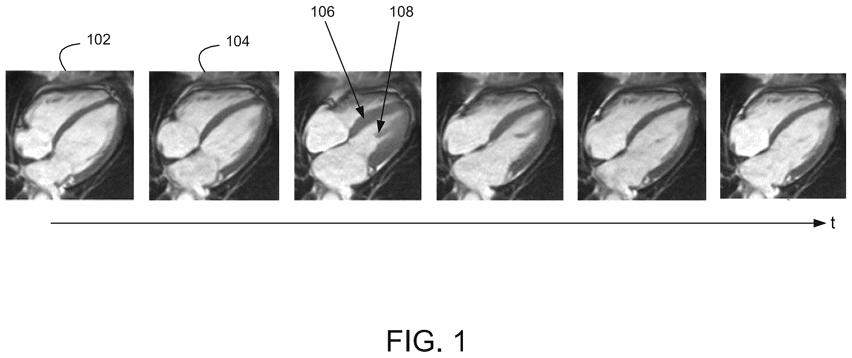 Patent US12586218 — Motion estimation with anatomical integrity — Figure 1