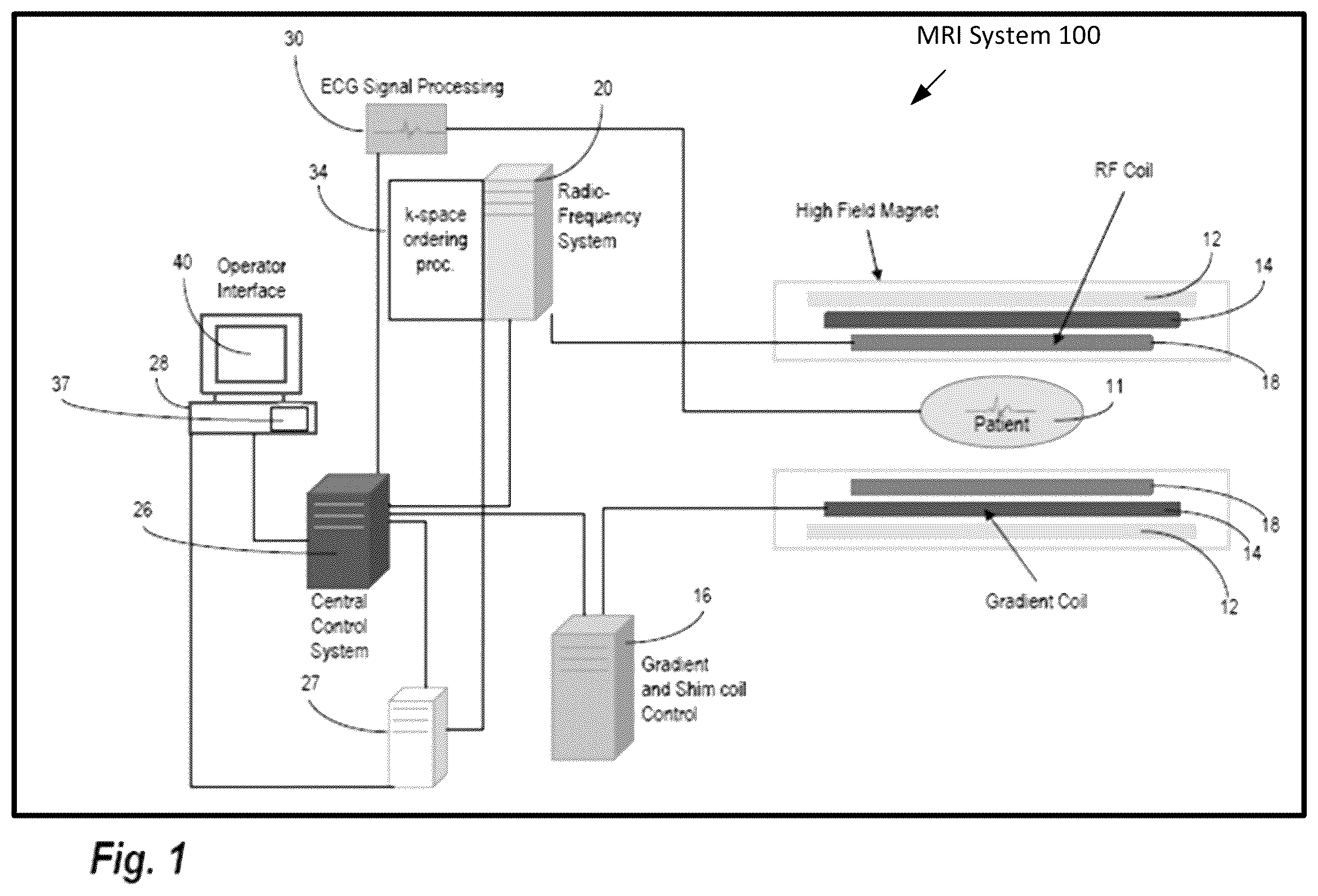 Patent US12586277 — Quasi-Newton MRI deep learning reconstruction — Figure 1