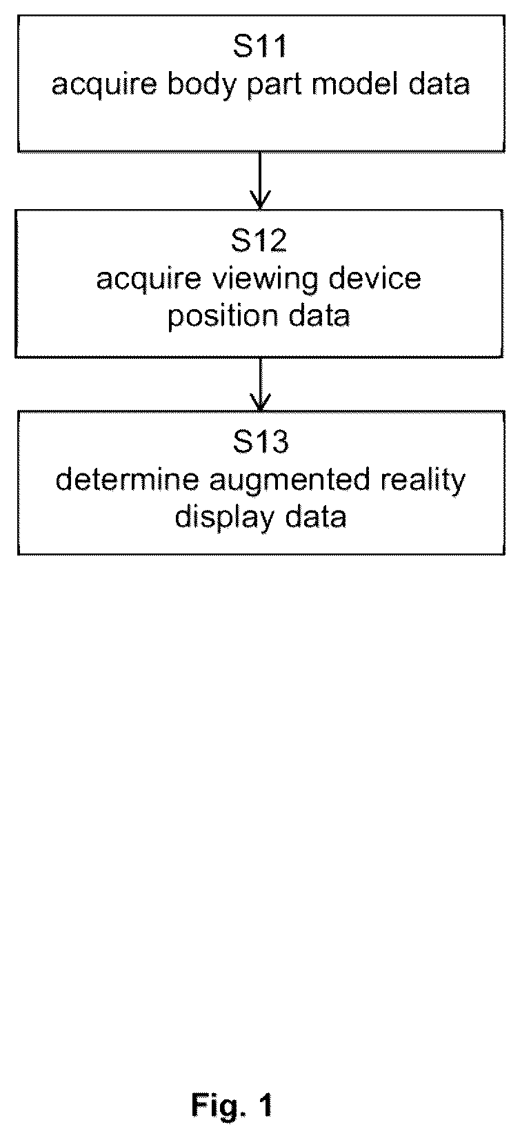 Patent US12586324 — Spine level determination using augmented reality — Figure 1