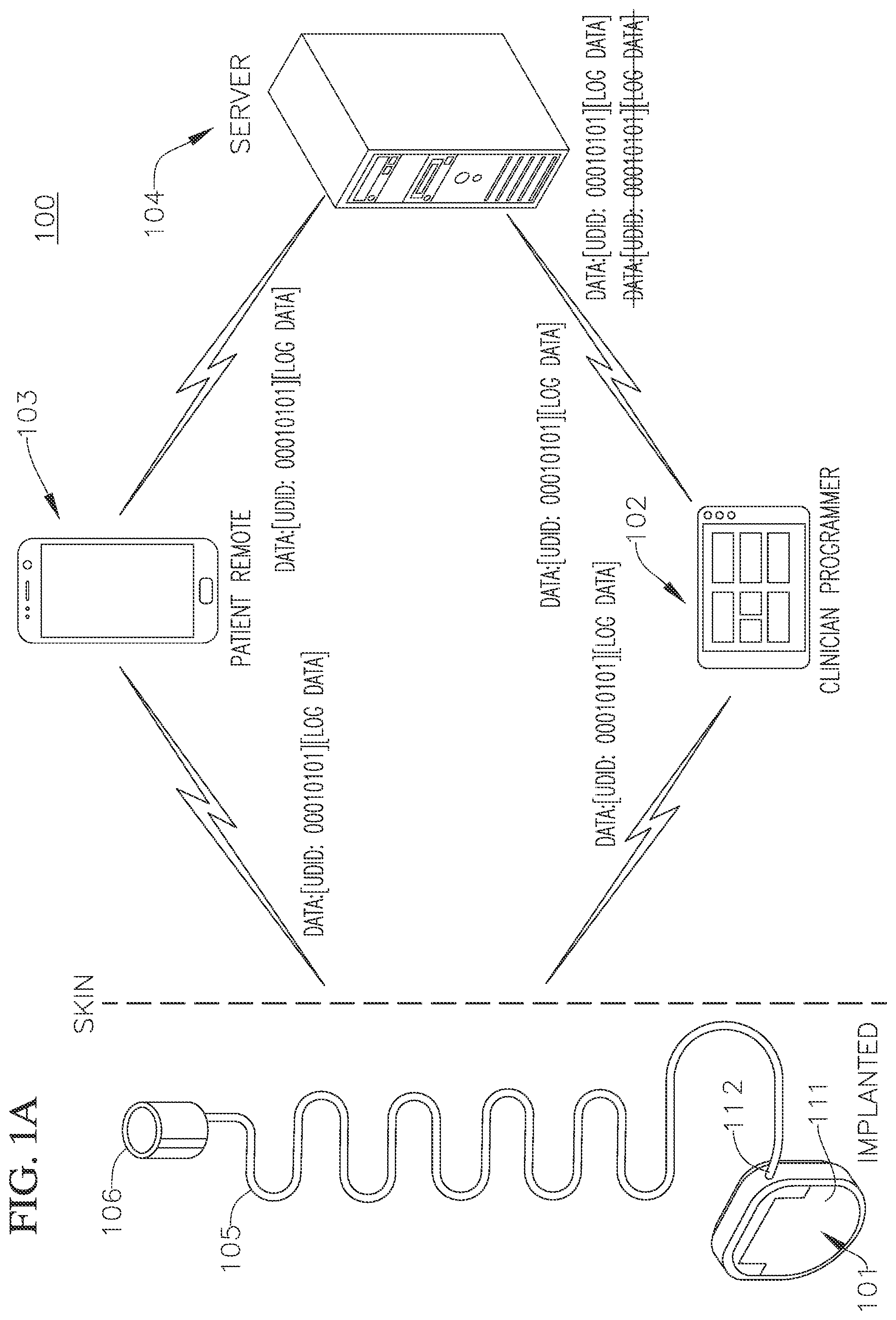 Patent US12586687 — Systems and methods of deduplicating data collected by an implantable medical device — Figure 1