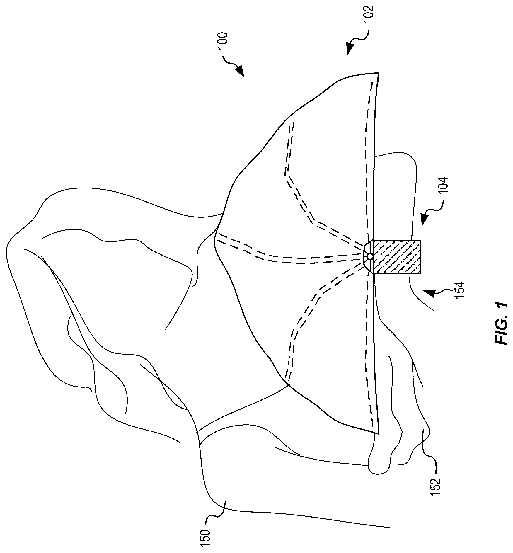 Patent US12588716 — Arm-mounted breastfeeding cover — Figure 1