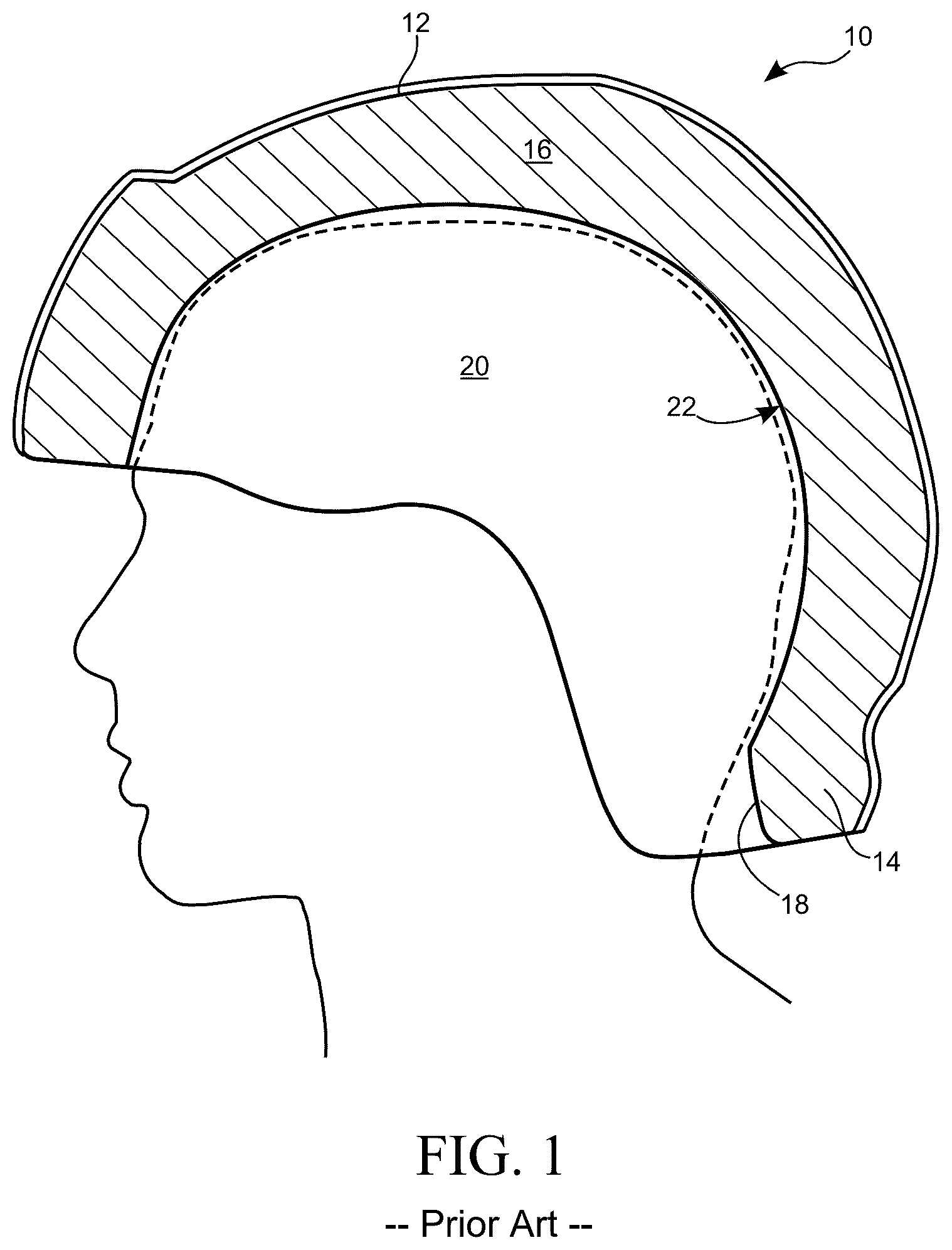 Patent US12588727 — Multi-layer helmet and method for making the same — Figure 1