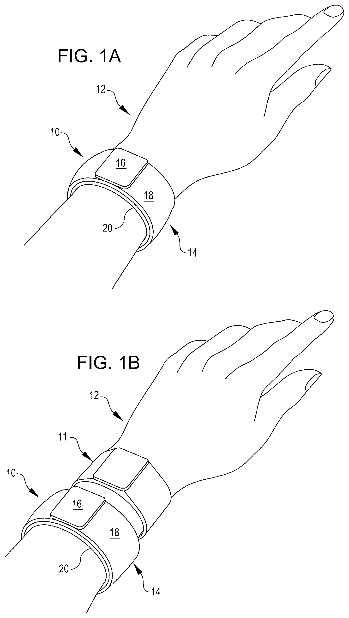 Patent US12588825 — Inflatable cuffs with controllable extensibility — Figure 1