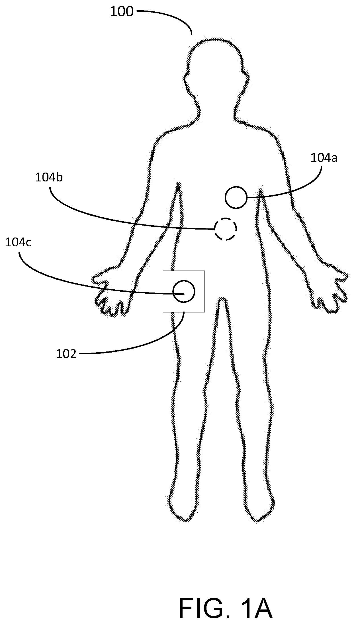 Patent US12588827 Figure 1 – Determining different sleep stages in a wearable medical device patient