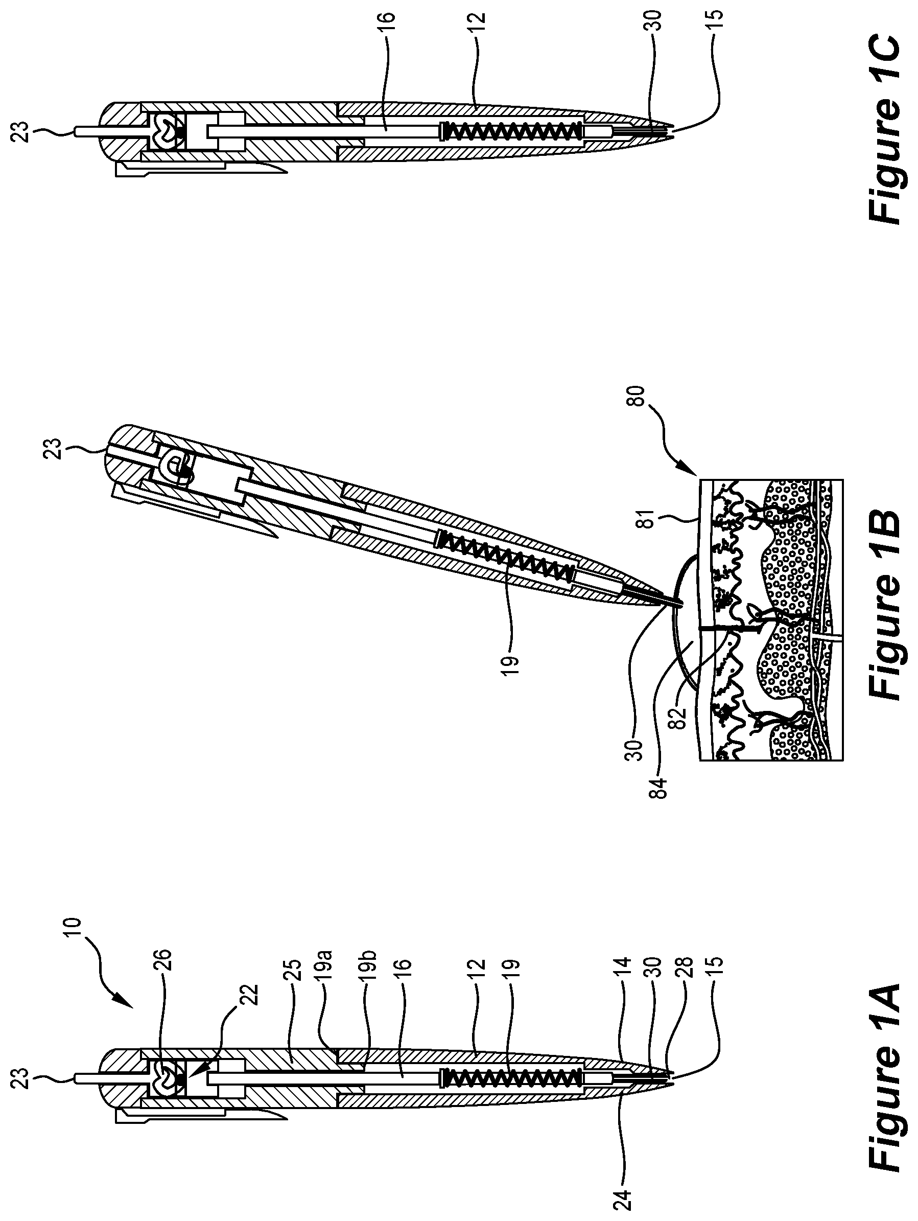 Patent US12588845 — Liquid collection device — Figure 1