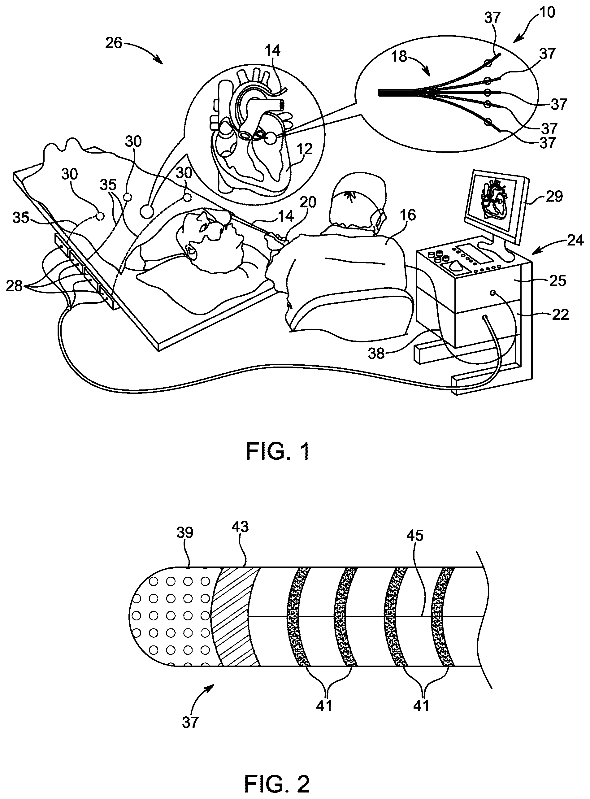 Patent US12588854 Figure 1 – Algorithm for optimal beat selection