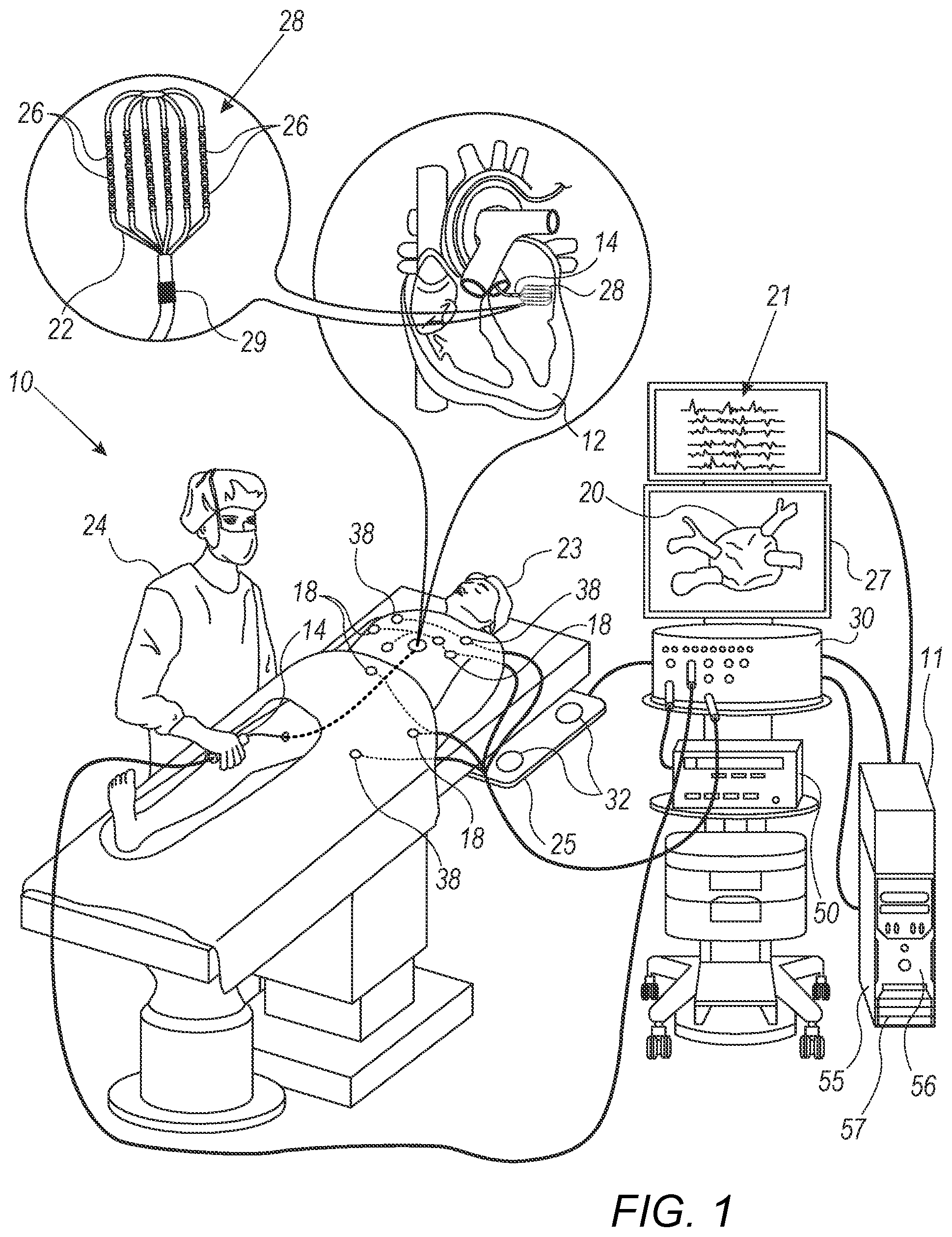 Patent US12588856 — Identifying and indicating cardiac areas exhibiting progressively slowing activation (PSA) — Figure 1