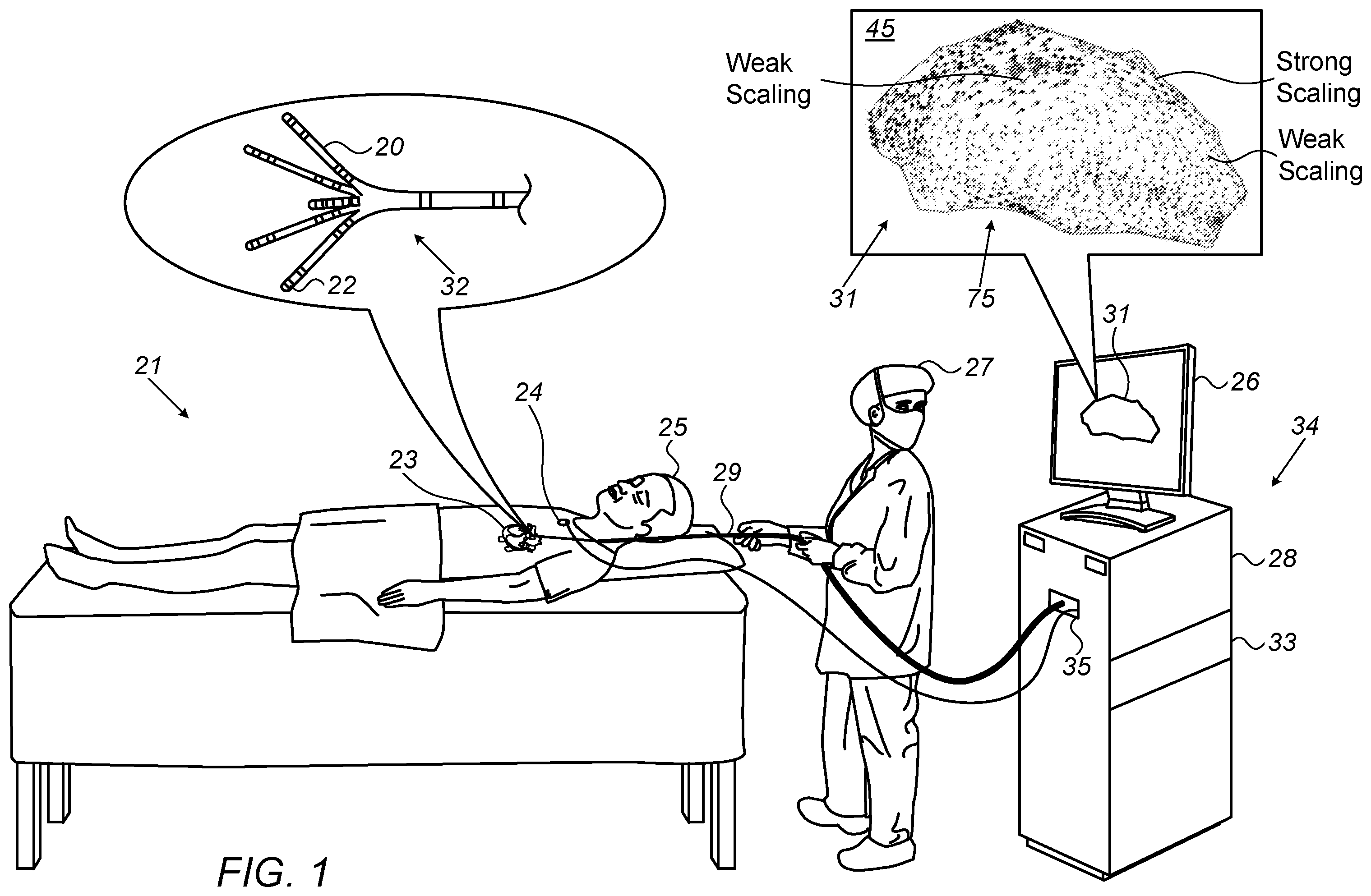 Patent US12588858 — Weighting projected electrophysiological wave velocity with sigmoid curve — Figure 1